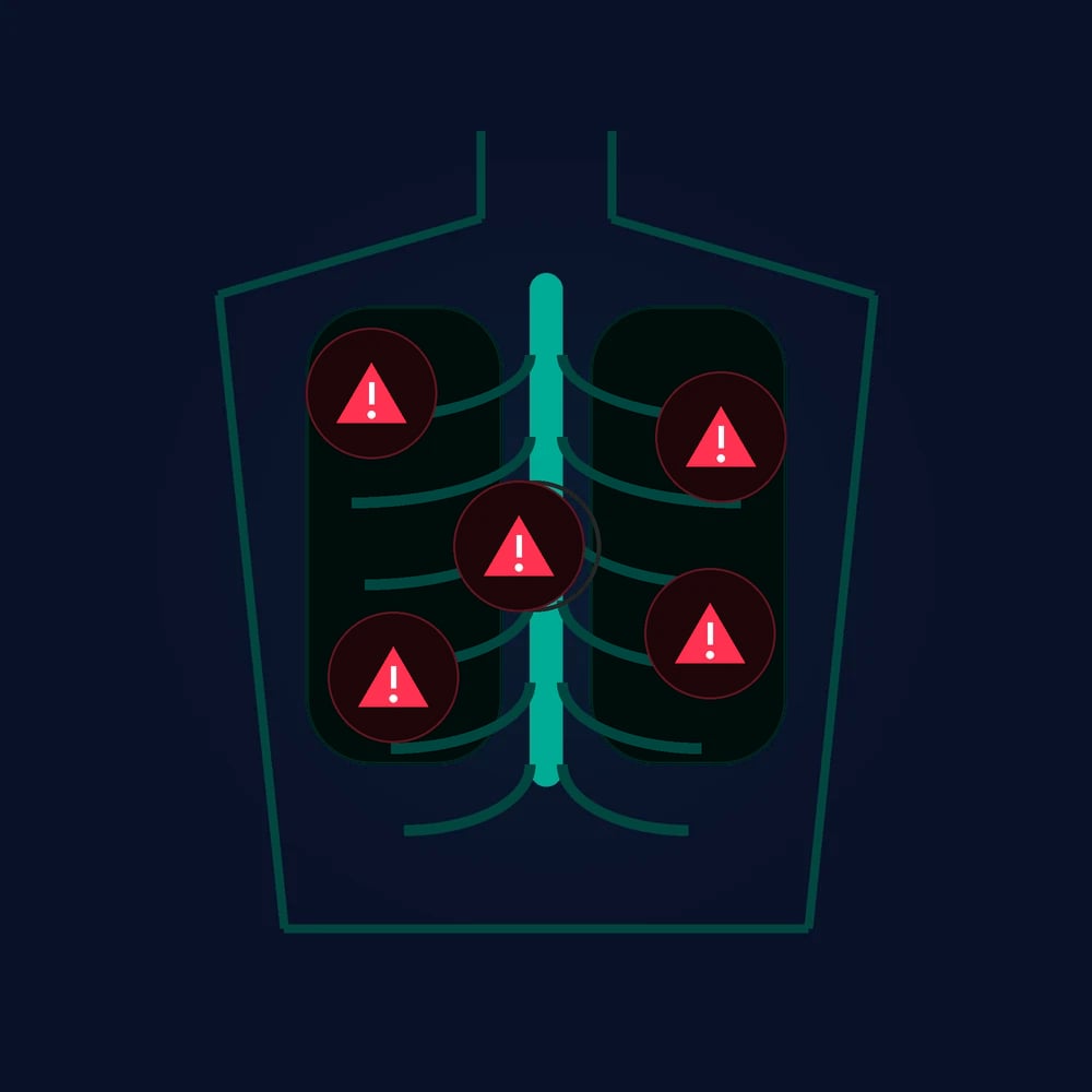 A stylised chest with five red warning symbols representing the five immediately life-threatening injuries