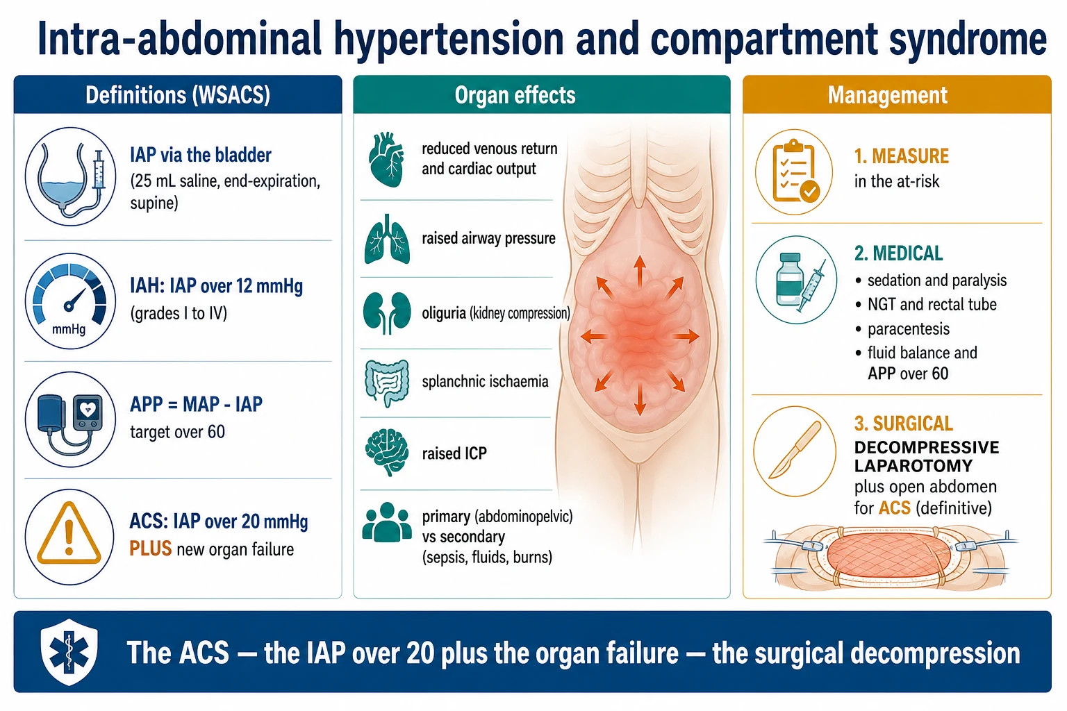 Educational schematic of abdominal compartment syndrome pathophysiology: raised intra-abdominal pressure, IVC compression, renal venous congestion, cephalad diaphragm and multi-organ failure