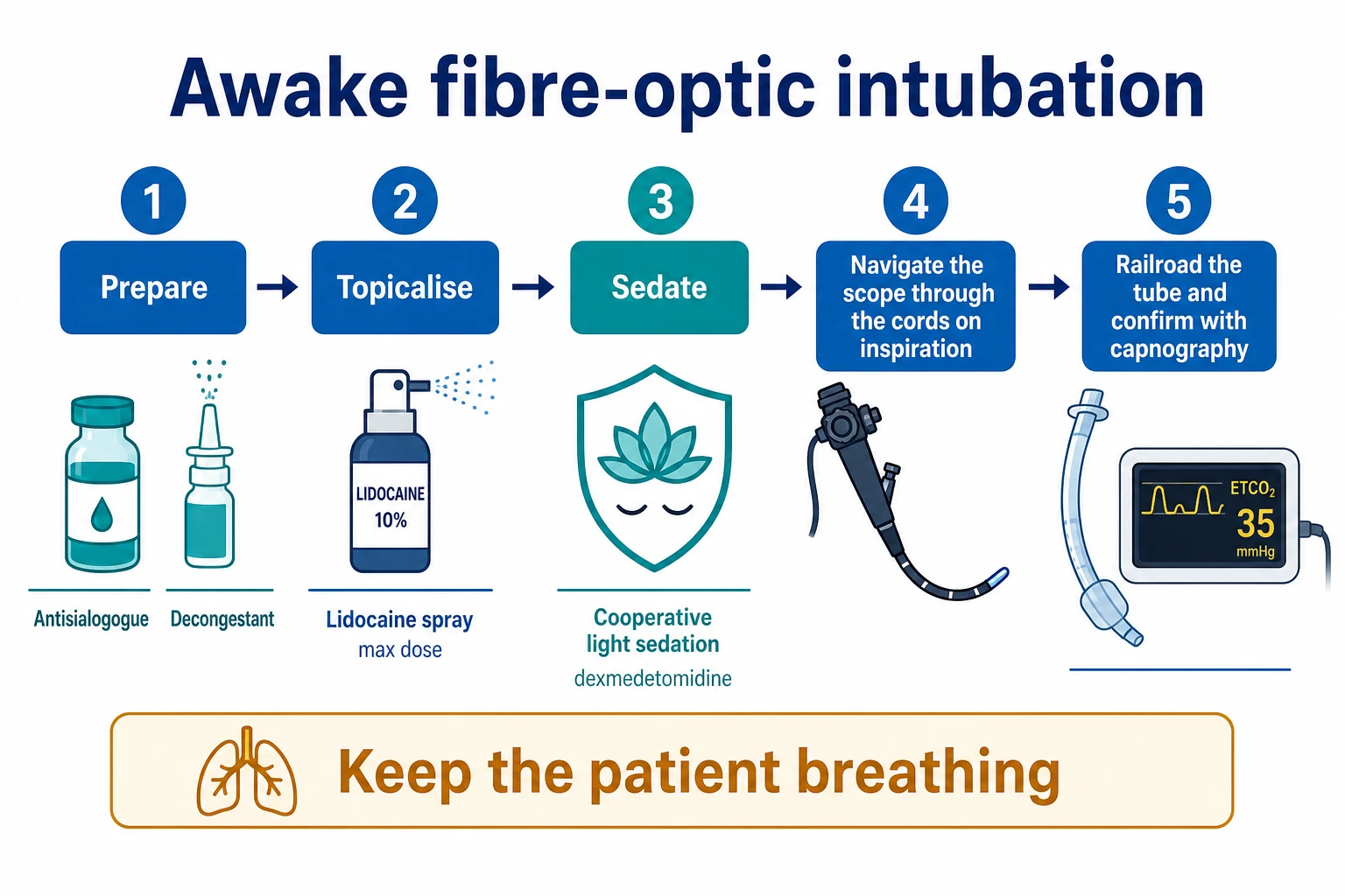 Horizontal five-step timeline infographic on a white clinical-blue background: 1 Prepare (antisialogogue, decongestant), 2 Topicalise (lidocaine spray, max dose), 3 Sedate (cooperative light sedation, dexmedetomidine), 4 Navigate the scope through the cords on inspiration, 5 Railroad the tube and confirm with capnography; side note 'keep the patient breathing'. Flat vector illustration, crisp typography.