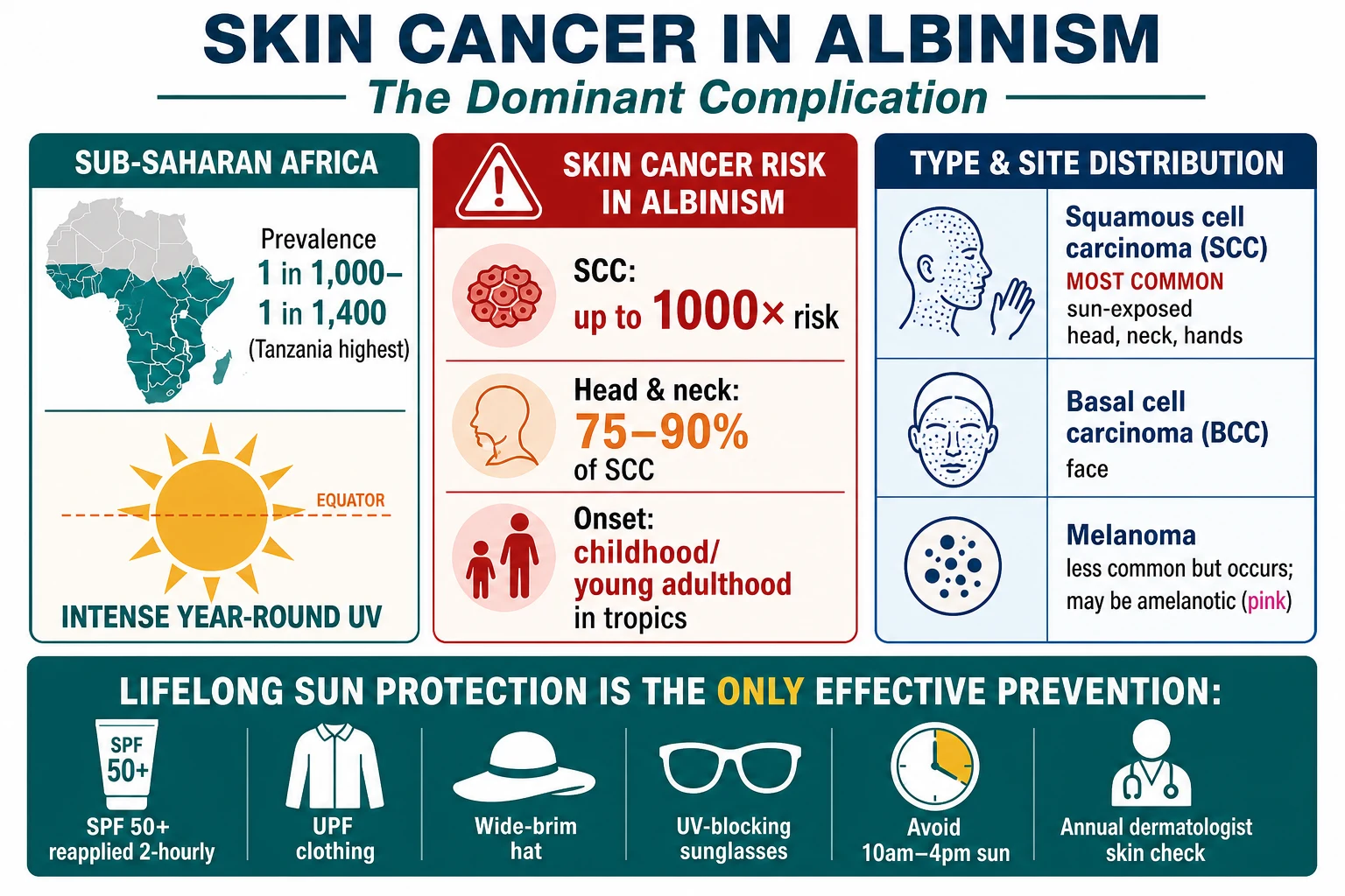 Skin cancer in albinism: high risk of squamous cell carcinoma of head and neck, basal cell carcinoma, and amelanotic melanoma; sub-Saharan Africa prevalence; sun protection as prevention