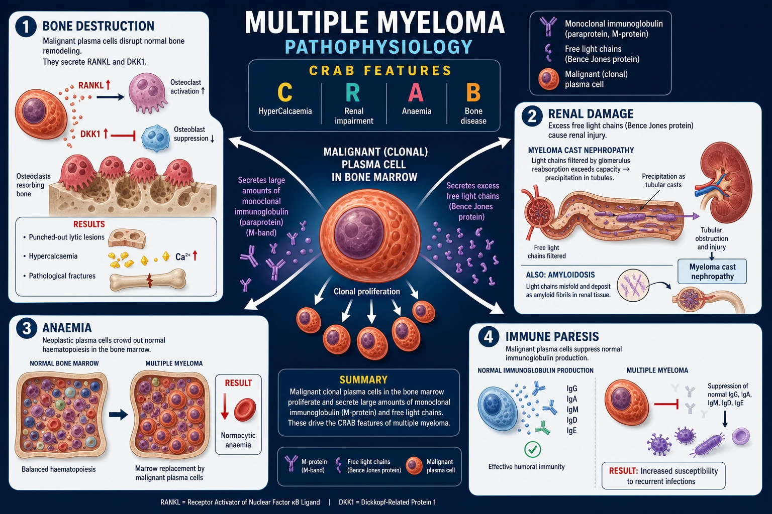 Medical textbook illustration of anaemia of chronic disease pathophysiology: a liver cell releasing hepcidin induced by IL-6, hepcidin degrading ferroportin on a macrophage and enterocyte, iron trapped in macrophages, suppressed erythropoiesis, and circulating normocytic normochromic red cells