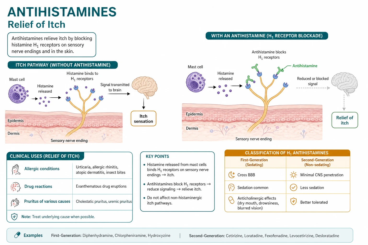 Two panels: (A) inverse agonist mechanism showing H1 receptor active state driven by histamine versus inactive state stabilised by an antihistamine; (B) hERG cardiotoxicity: terfenadine blocks the hERG potassium channel causing QT prolongation and Torsades de Pointes, while fexofenadine does not block hERG and is safe.