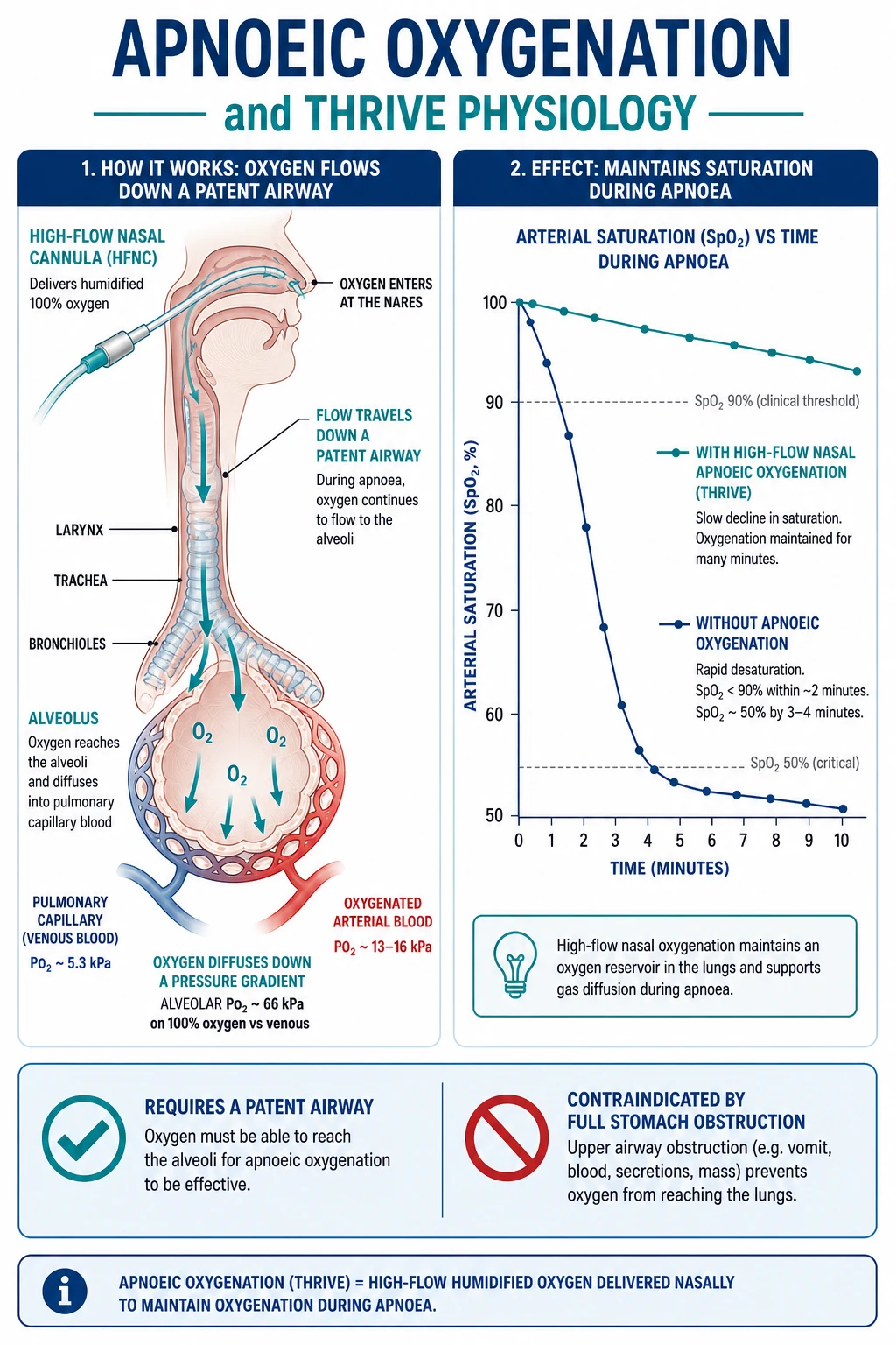 Apnoeic oxygenation physiology and THRIVE setup diagram