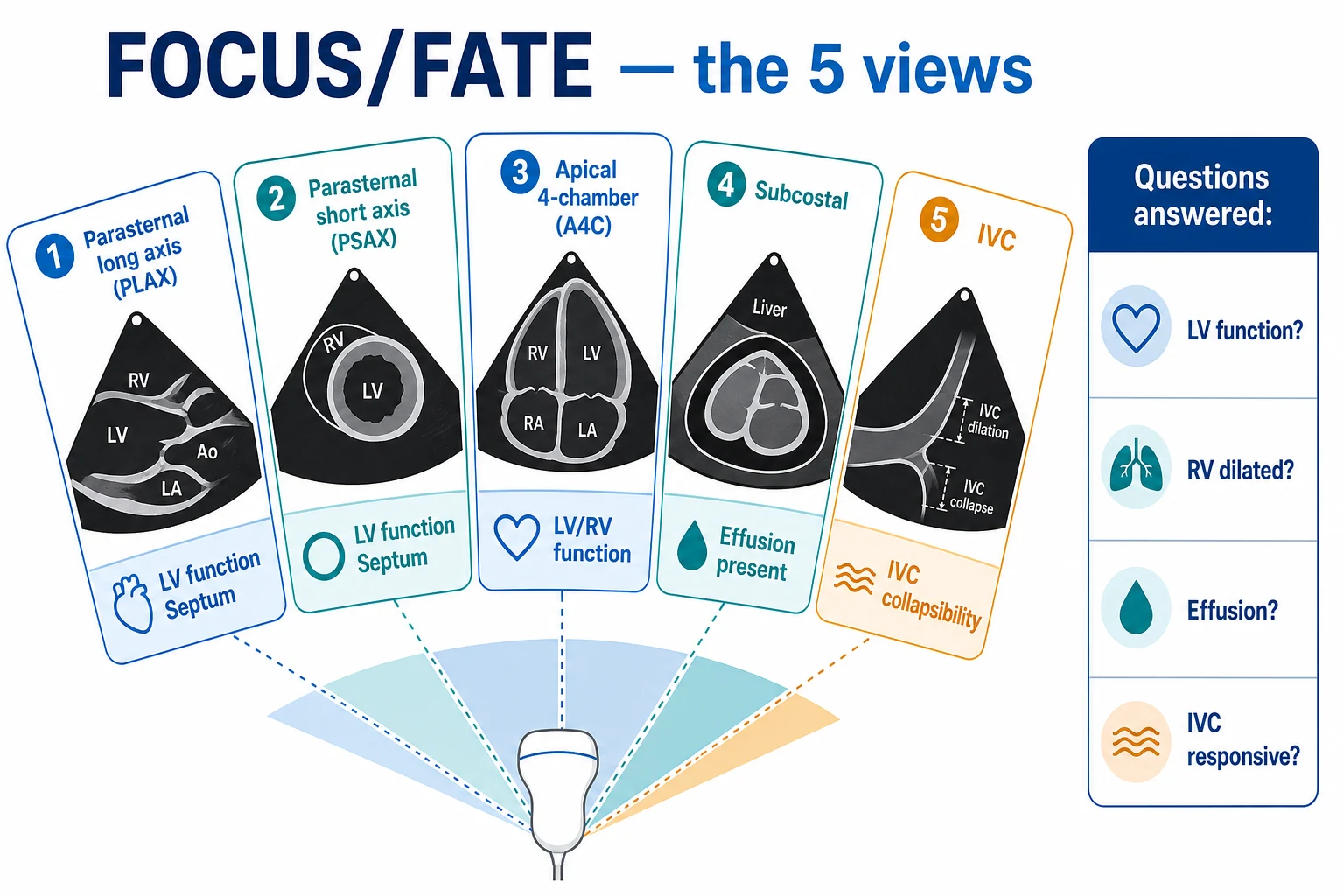 Five-window fan infographic on a white clinical-blue background: 1 Parasternal long axis (PLAX — LV/RV, valves), 2 Parasternal short axis (PSAX — septum, regional wall motion), 3 Apical 4-chamber (A4C — all four chambers), 4 Subcostal (effusion, chambers), 5 IVC (size and collapse); side banner 'Questions: LV function? RV dilated? Effusion? IVC responsive?'. Flat vector illustration, crisp typography.