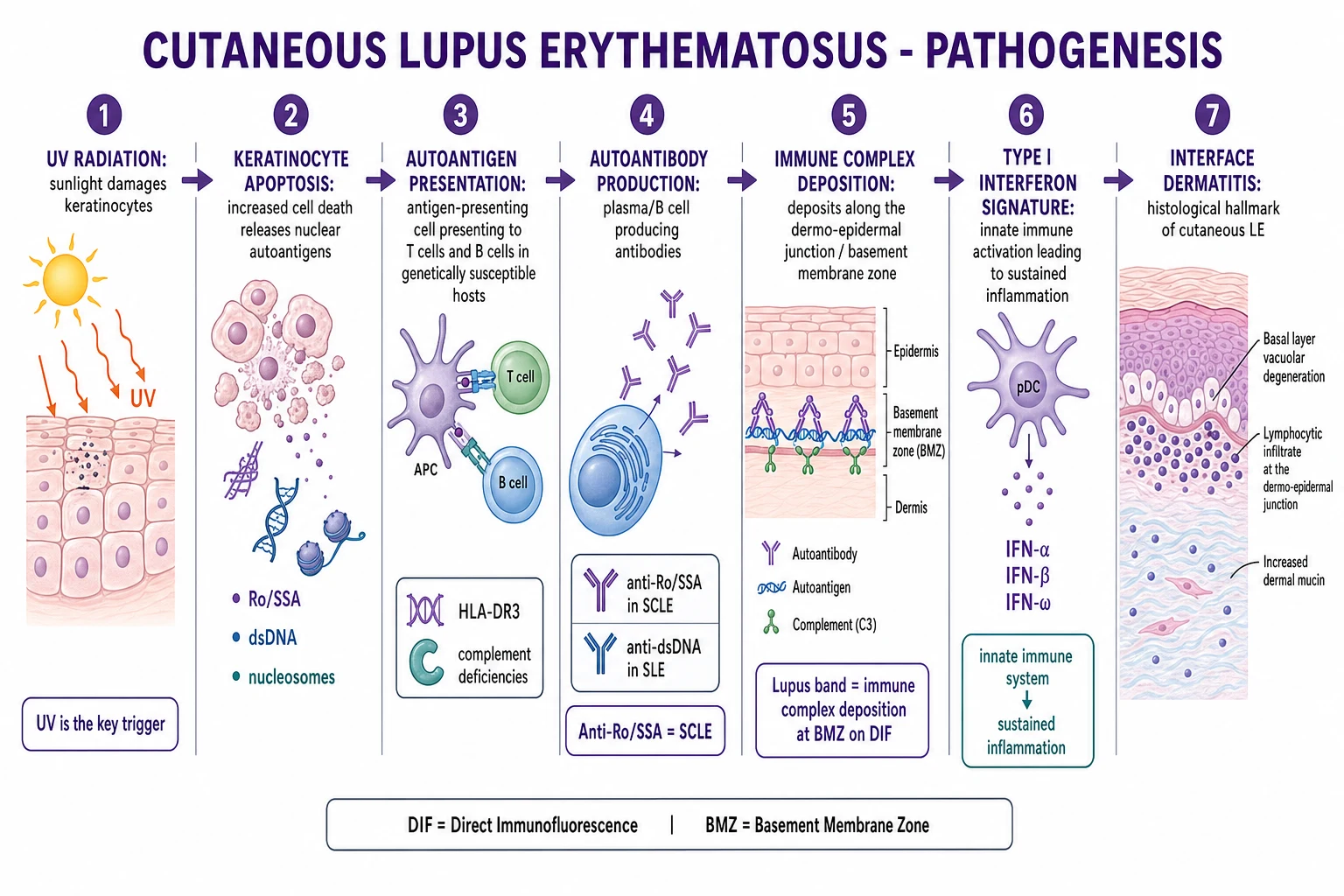 UVB → keratinocyte apoptosis → autoantigen (Ro/SSA, dsDNA, nucleosomes) exposure on apoptotic blebs → plasmacytoid dendritic cell recruitment → Type I IFN signature → CD4/CD8 T-cell and B-cell amplification → immune complex deposition at basement membrane zone → complement activation → interface dermatitis