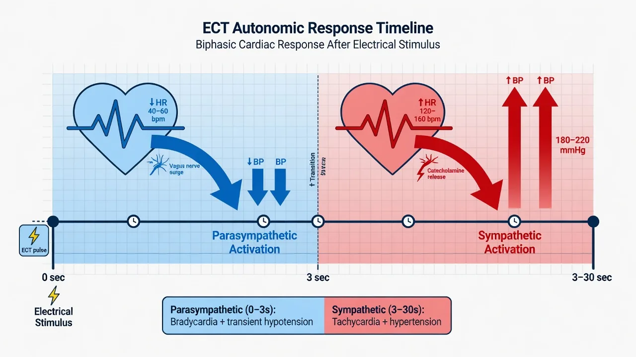 Anaesthesia for electroconvulsive therapy (ECT) educational diagram