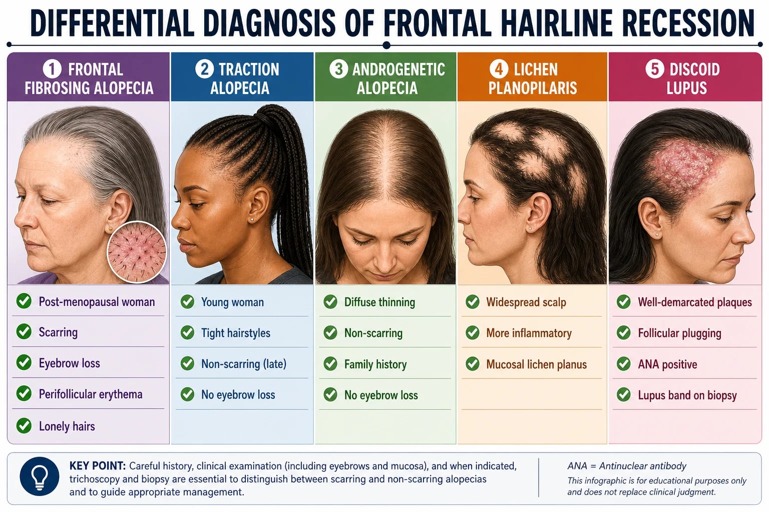 Differential diagnosis comparison table of five conditions causing frontal hairline recession: frontal fibrosing alopecia, traction alopecia, androgenetic alopecia, lichen planopilaris, and discoid lupus erythematosus