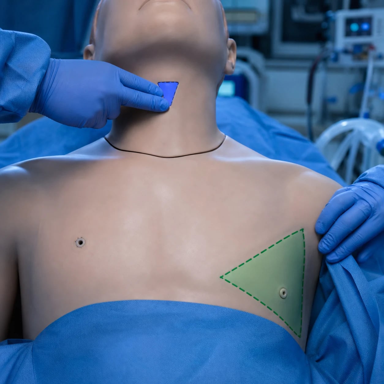 Cinematic clinical photograph of ICU procedural landmarks, the cricothyroid membrane and chest-drain safe triangle marked on a sterile-draped manikin torso, clinical-blue lighting, no faces, no text