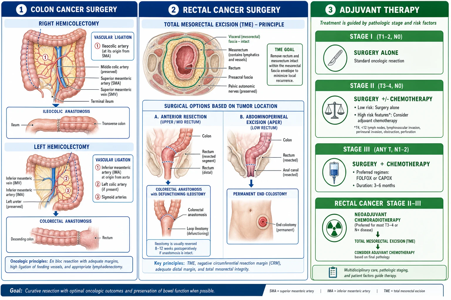 Stomach anatomy showing common gastric cancer sites: antral/distal (H. pylori, bleeding), body/diffuse (linitis plastica, signet ring), and cardia/proximal (dysphagia, rising incidence). Metastatic sites: Virchow node, liver, peritoneum (Krukenberg).