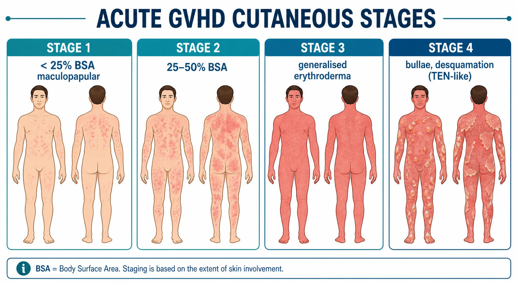 Chronic GVHD patterns: lichenoid (violaceous papules), sclerodermoid (indurated fibrotic skin), poikiloderma, fasciitis with joint contractures
