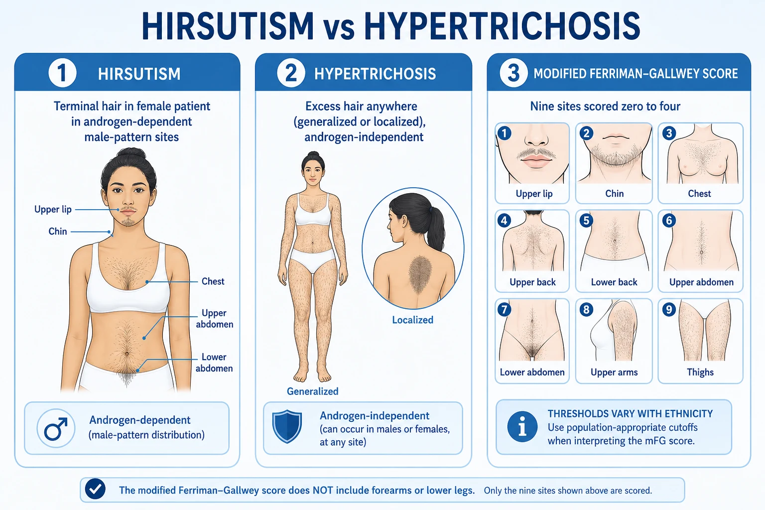 Classification infographic comparing hirsutism, hypertrichosis and the modified Ferriman-Gallwey sites