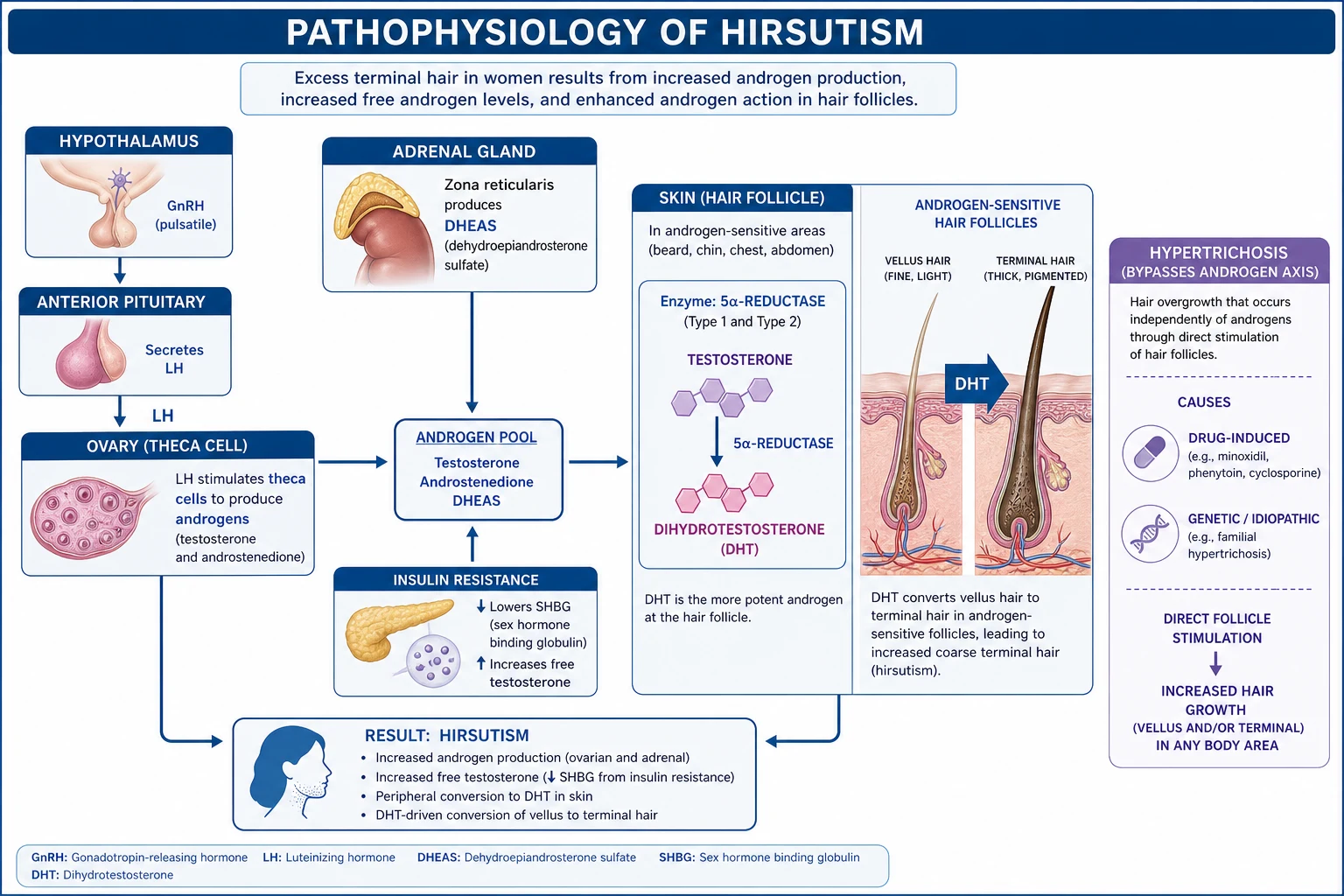 Endocrine pathophysiology diagram for androgen-mediated hirsutism