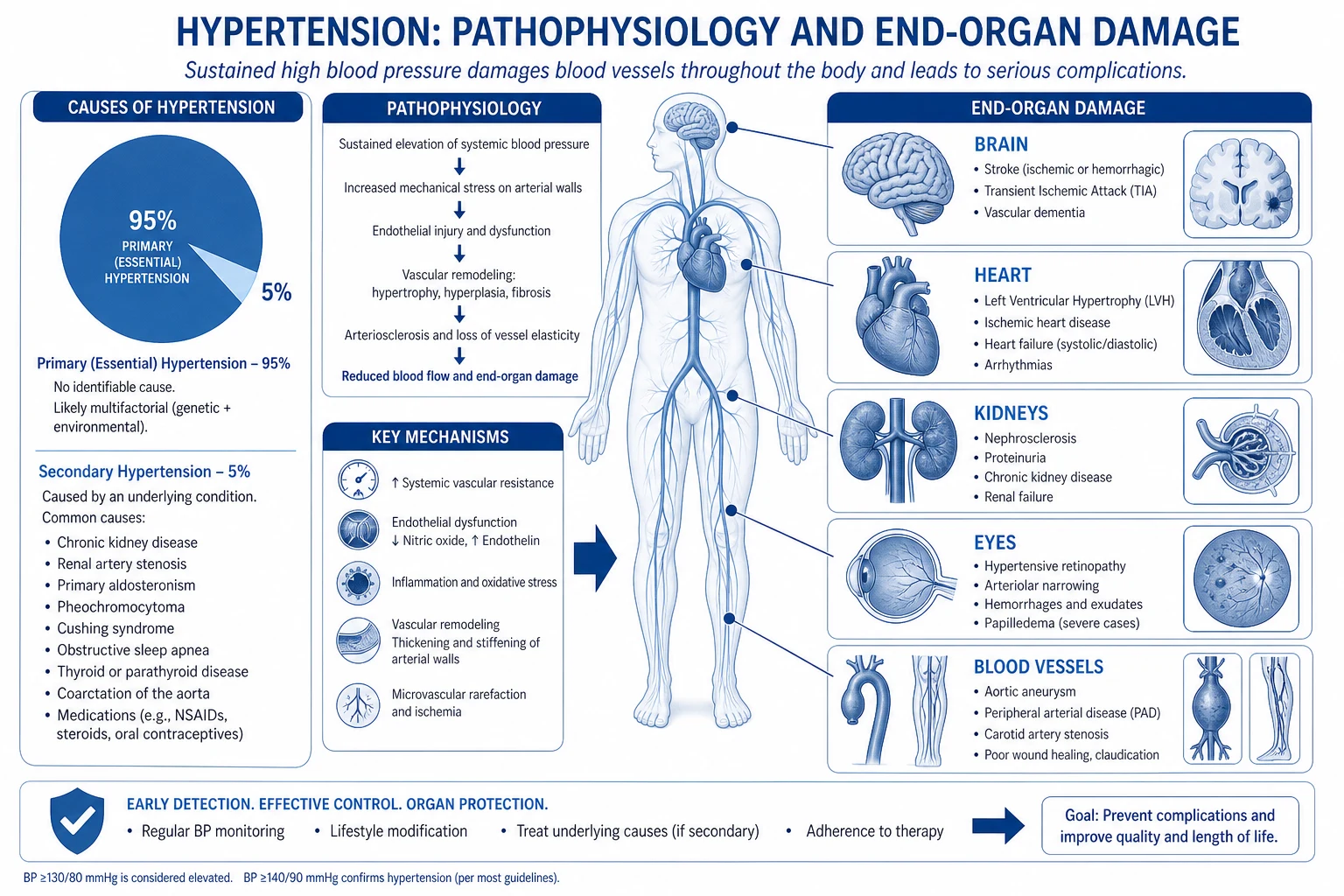 Infographic of hypertension pathophysiology showing the four drivers — renal pressure natriuresis shift, RAAS activation, sympathetic overactivity, endothelial dysfunction and arterial stiffening — converging on raised systemic vascular resistance and end-organ damage