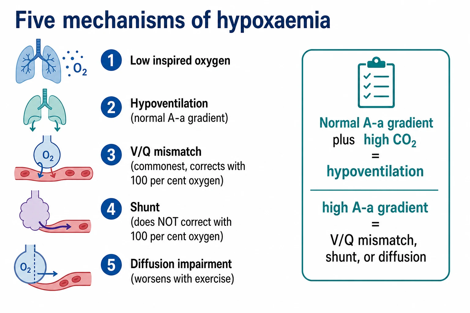 Five-row infographic on a white clinical-blue background: 1 Low inspired oxygen, 2 Hypoventilation (normal A-a gradient), 3 V/Q mismatch (commonest, corrects with 100 per cent oxygen), 4 Shunt (does NOT correct with 100 per cent oxygen), 5 Diffusion impairment (worsens with exercise); decision box 'Normal A-a gradient plus high CO2 equals hypoventilation; high A-a gradient equals V/Q mismatch, shunt, or diffusion'. Flat vector illustration, crisp typography.