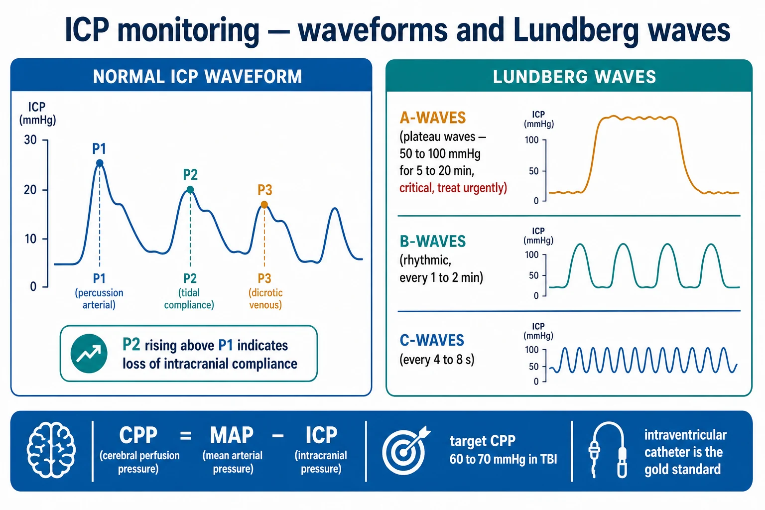 Two-panel infographic on a white clinical-blue background: LEFT the normal ICP waveform with P1 (percussion arterial), P2 (tidal compliance), P3 (dicrotic venous) — a P2 rising above P1 indicates a loss of compliance; RIGHT the Lundberg waves: A-waves (plateau, 50 to 100 mmHg, 5 to 20 min, critical), B-waves (rhythmic, every 1 to 2 min), C-waves (every 4 to 8 s); banner 'CPP equals MAP minus ICP; target CPP 60 to 70; intraventricular catheter is the gold standard'. Flat vector illustration, crisp typography.