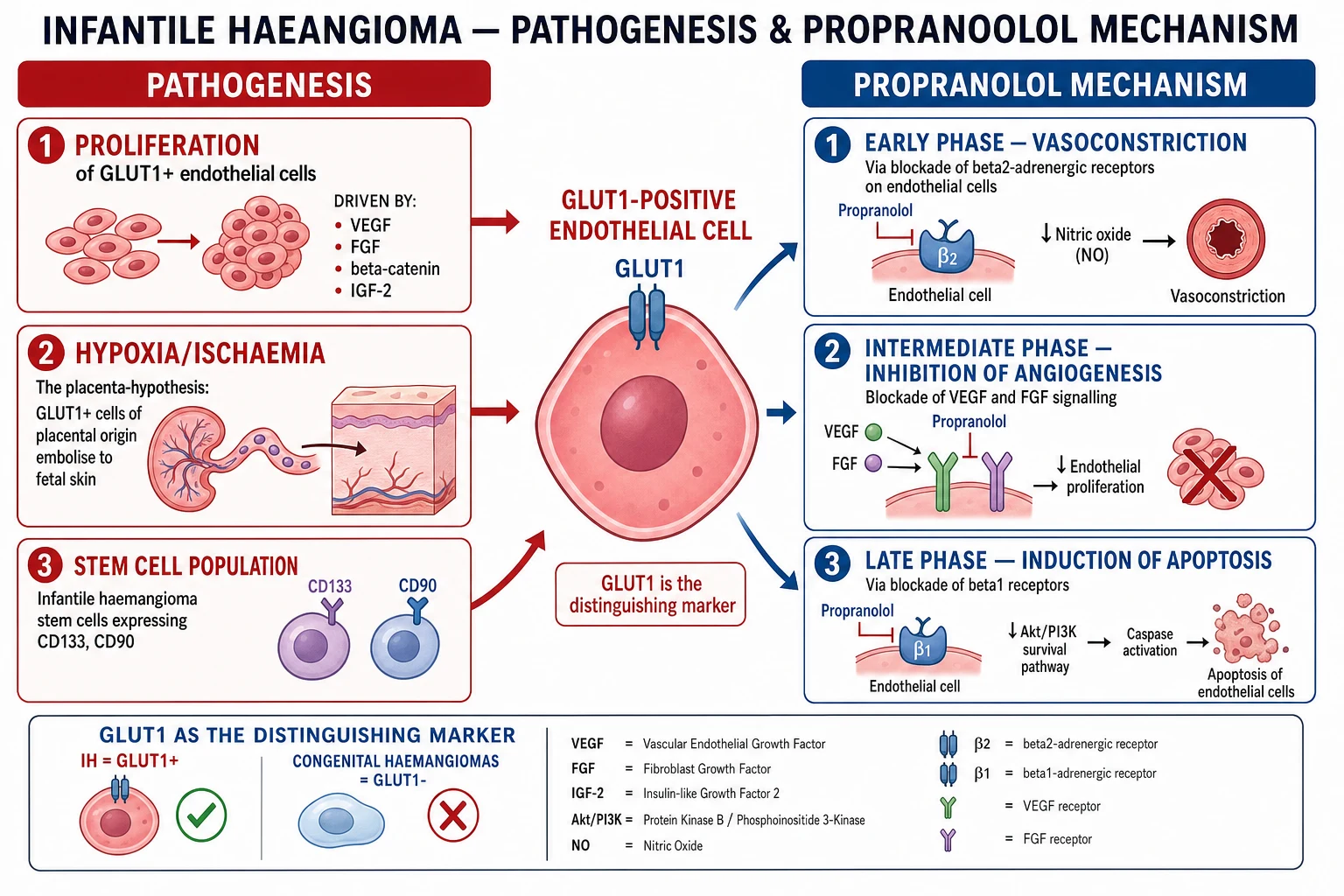GLUT1+ endothelial cell proliferation driven by VEGF/FGF/β-catenin; propranolol mechanism: vasoconstriction (β2 blockade → NO↓) + anti-angiogenesis (VEGF/FGF↓) + apoptosis (β1 blockade → Akt/PI3K↓ → caspase)