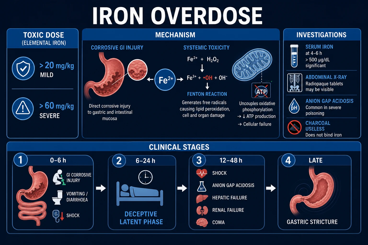 Clean clinical infographic on a deep navy background titled Iron Overdose Classification and Staging, showing the elemental-iron toxic-dose ladder on the left (under 20 mg/kg asymptomatic, 20 to 40 mild, 40 to 60 significant, over 60 severe) and the four clinical stages as a horizontal timeline on the right (Stage 1 0 to 6 h GI corrosive injury, Stage 2 6 to 24 h deceptive latent phase, Stage 3 12 to 48 h shock plus acidosis plus hepatic failure, Stage 4 4 to 6 weeks gastric stricture), with the elemental-iron content of ferrous sulphate, fumarate and gluconate noted at the bottom