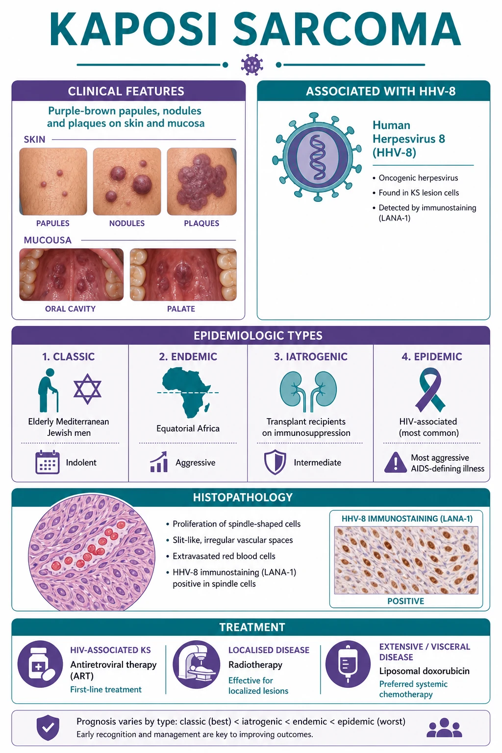 Purple-brown macules, patches, plaques and nodules on lower leg and hard palate; HHV-8 infection of lymphatic endothelium producing spindle cells and slit-like vascular spaces; four epidemiologic variants