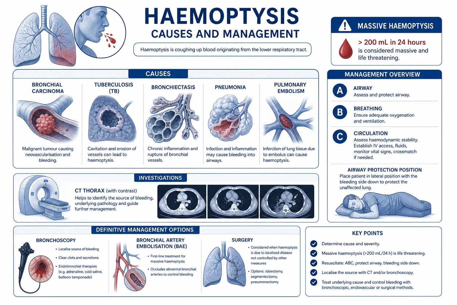 Educational diagram of massive haemoptysis sources: bronchial artery high-pressure bleeding versus pulmonary artery, airway flooding and asphyxia mechanism, clinical-blue