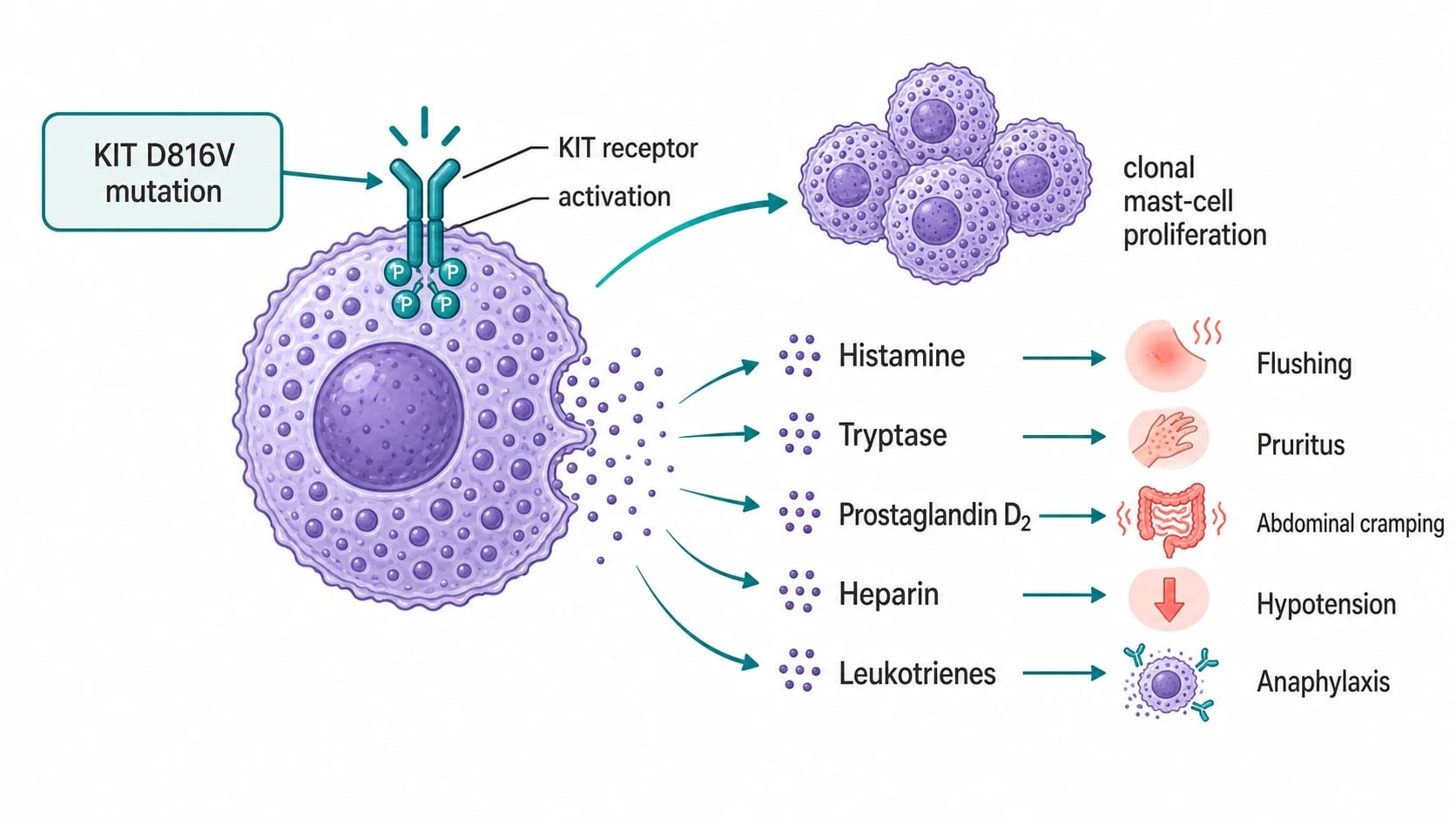 Mastocytosis pathophysiology schematic: CD34+ progenitor, KIT D816V gain-of-function mutation causing constitutive signalling and clonal mast cell proliferation; triggers (friction, heat, exercise, alcohol, NSAIDs, opiates, iodinated contrast, Hymenoptera venom) causing degranulation and release of histamine, prostaglandin D2, leukotrienes, heparin, platelet-activating factor, tryptase; clinical effects of flushing, pruritus, wheal and flare, abdominal cramping, diarrhoea, hypotension, bronchospasm, anaphylaxis; serum tryptase as a diagnostic marker of mast cell burden