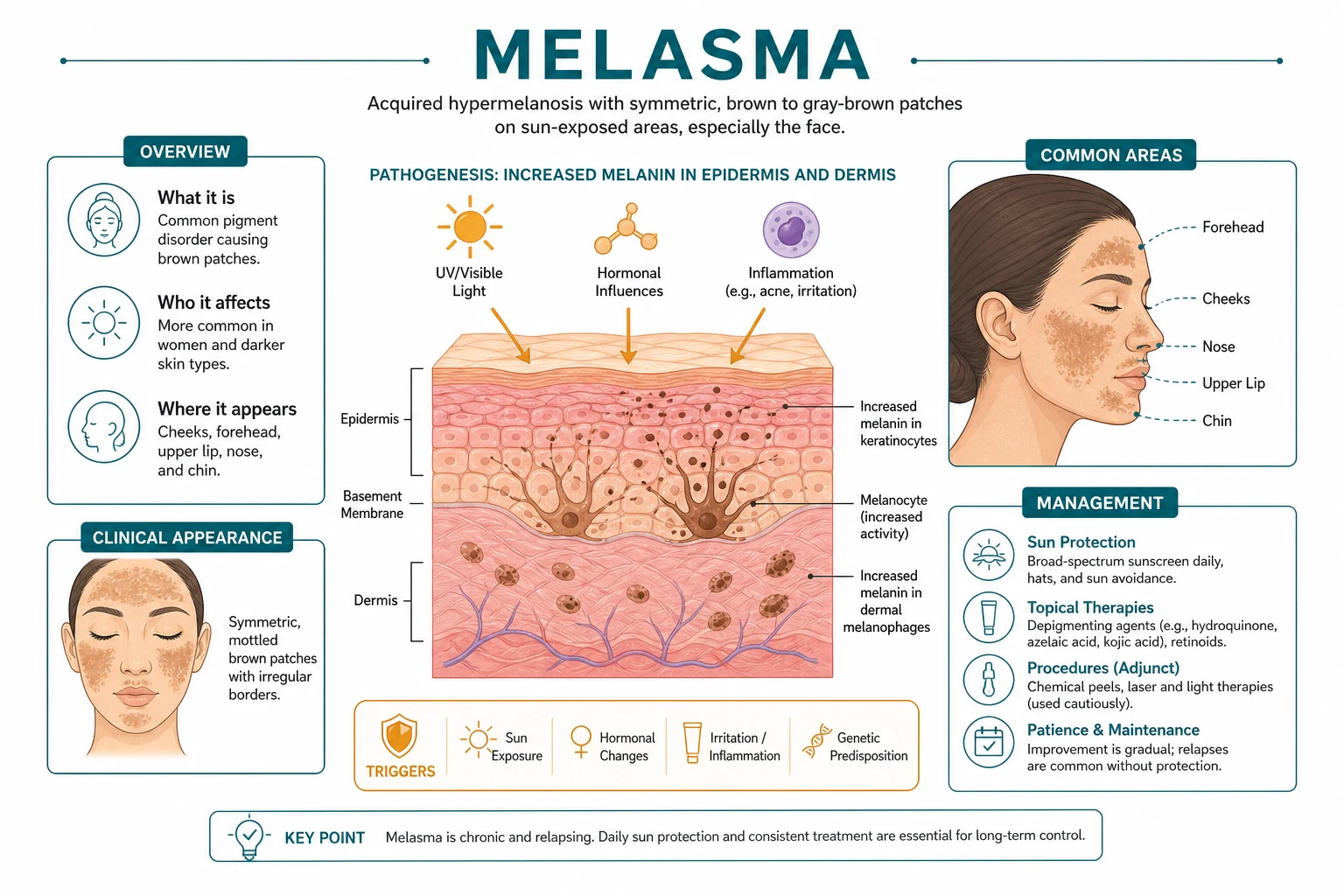Three-panel Wood's lamp comparison: epidermal melasma shows accentuated brown pigmentation, dermal melasma shows no accentuation with a blue-grey hue, and mixed melasma shows partial accentuation.