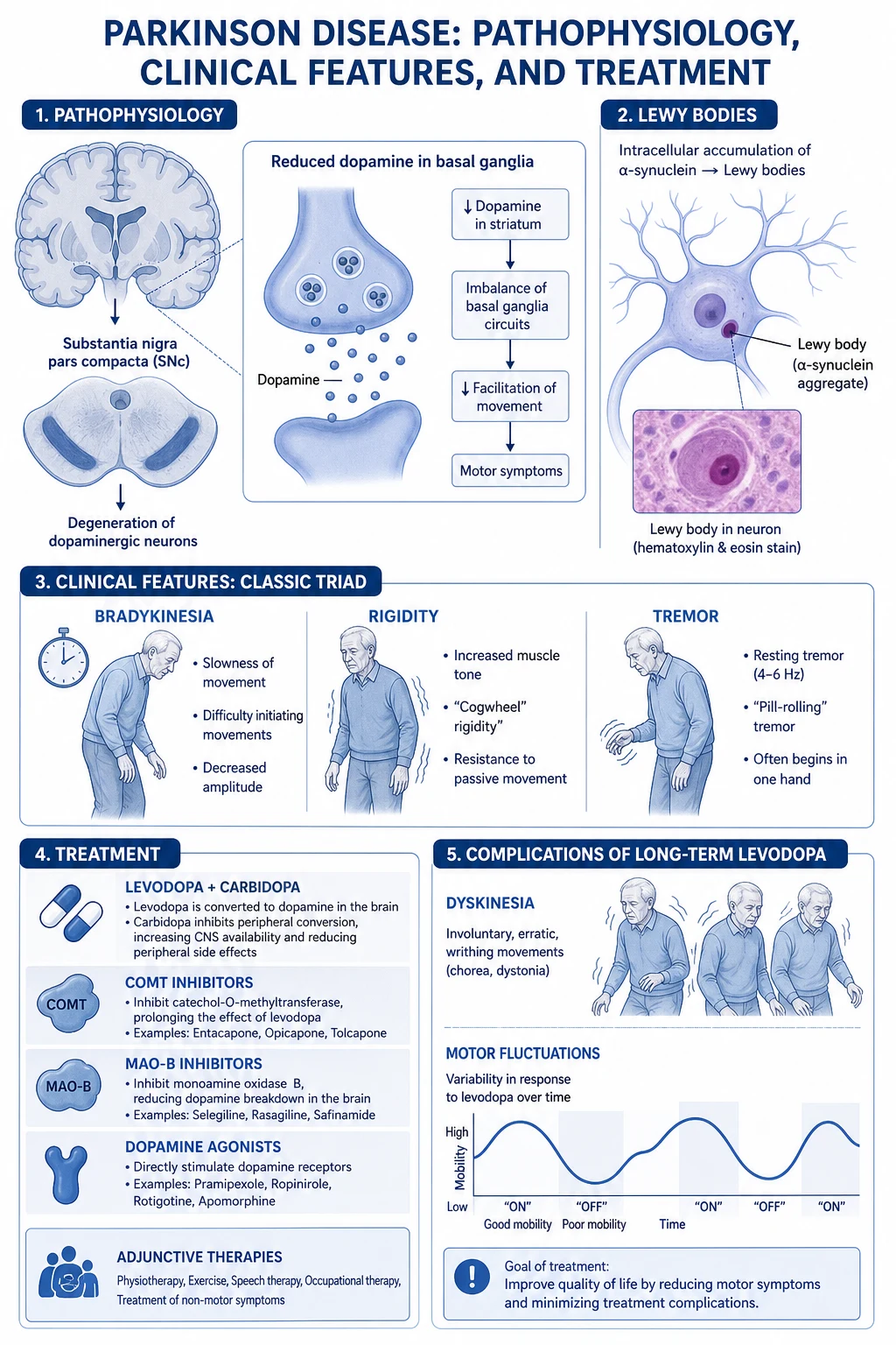 Mechanism infographic — substantia nigra dopaminergic neuron loss, alpha-synuclein Lewy body, direct/indirect basal ganglia pathway imbalance, Braak caudal-to-rostral spread
