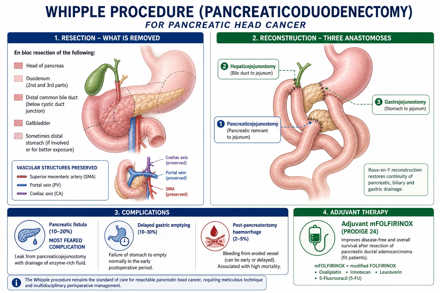 Stomach and duodenum showing DU (first part, relieved by food) vs GU (lesser curvature, worsened by food). H. pylori and NSAIDs as major causes.