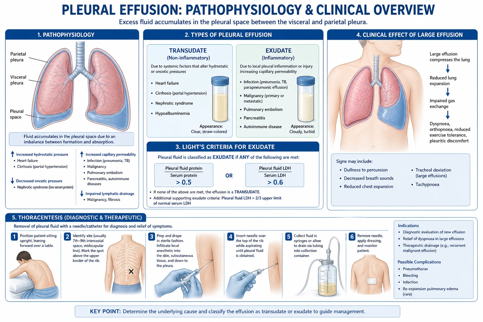 Pleural fluid formation mechanisms and parapneumonic progression from simple effusion to complicated effusion to empyema with fibrin septations