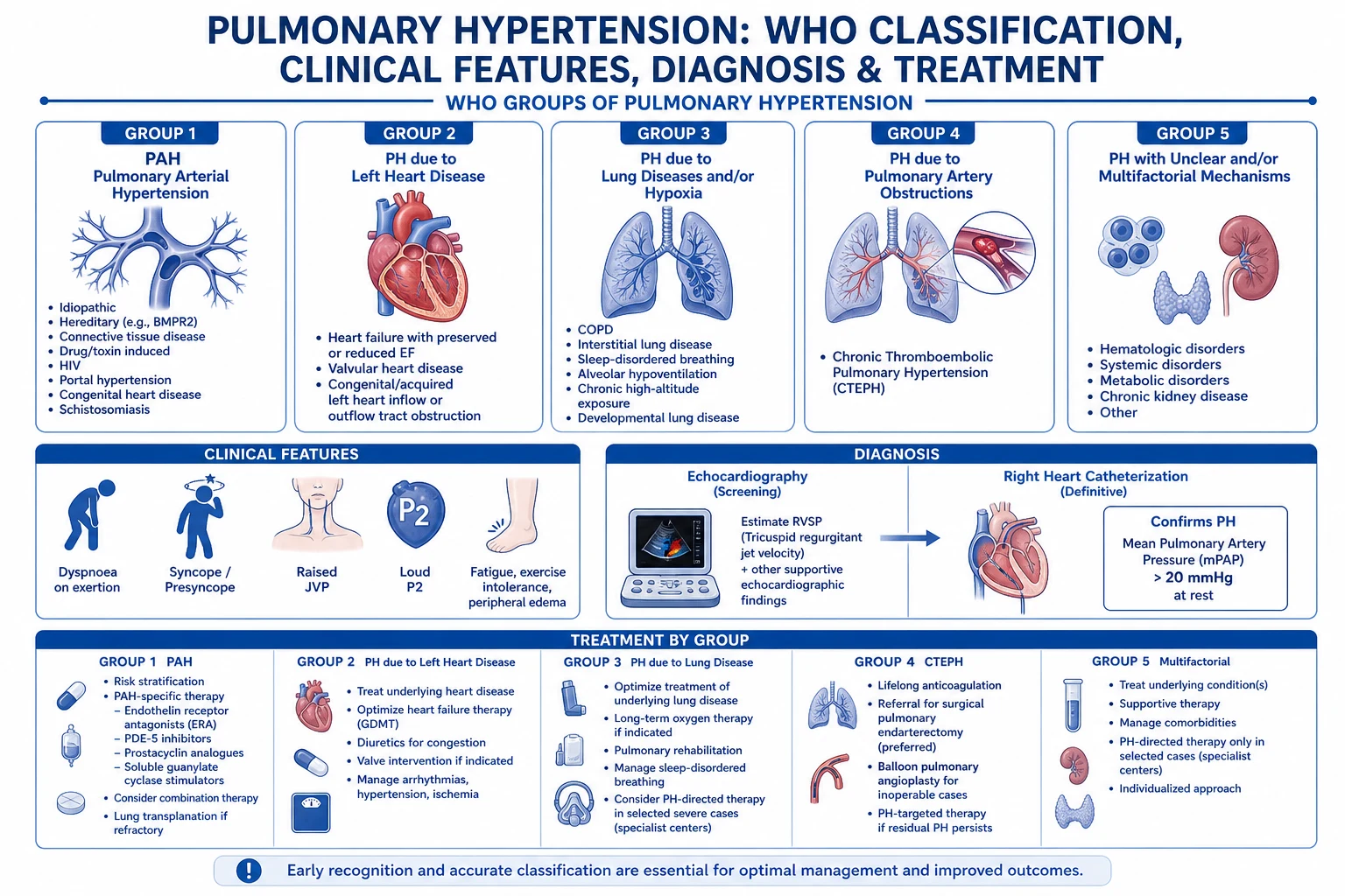 Pathophysiology of pulmonary hypertension leading to cor pulmonale: elevated pulmonary vascular resistance, pressure-overloaded right ventricle, septal bowing into the left ventricle, and falling cardiac output