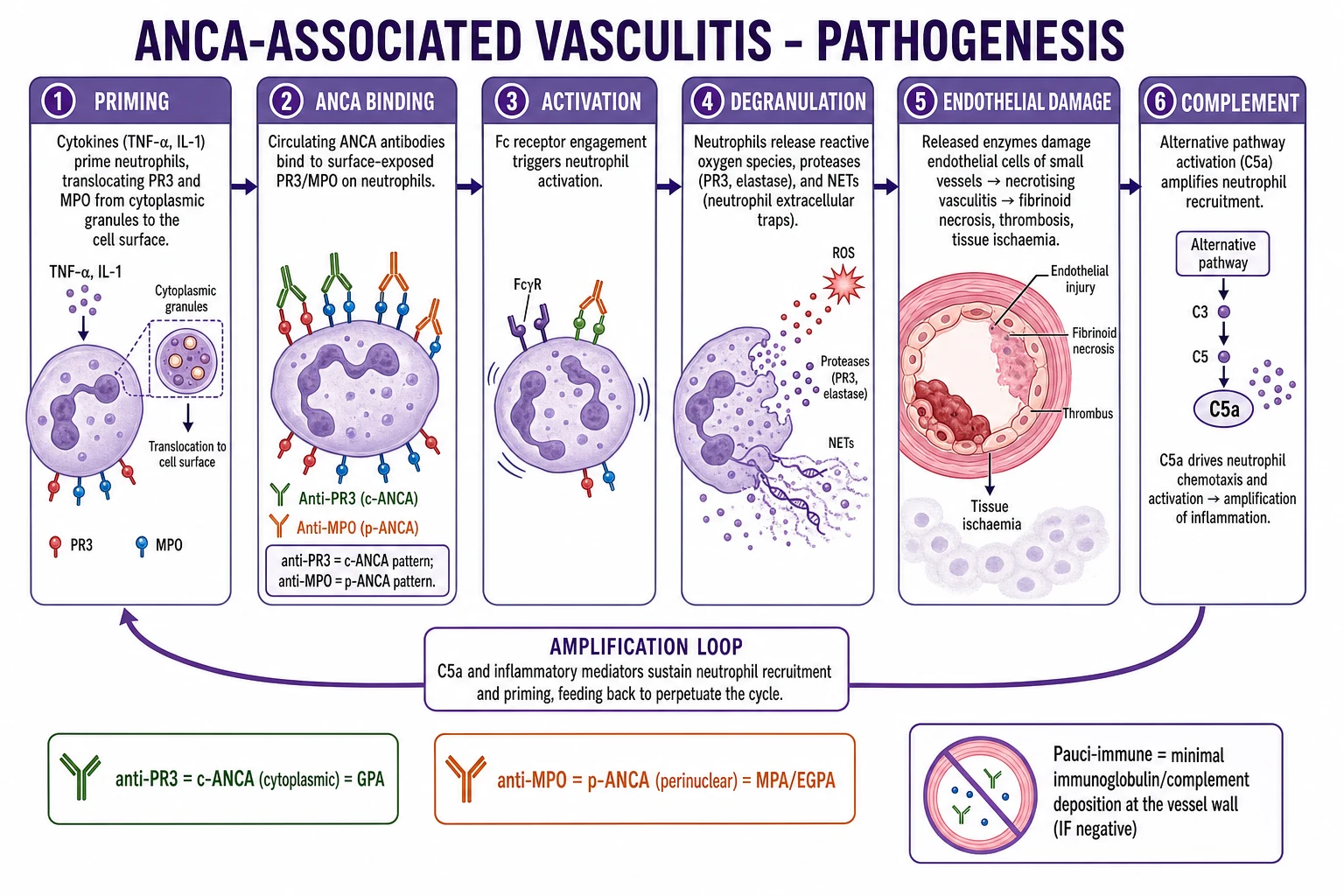Educational diagram of scleroderma renal crisis pathophysiology: endothelial injury, renin-angiotensin activation, TMA pattern