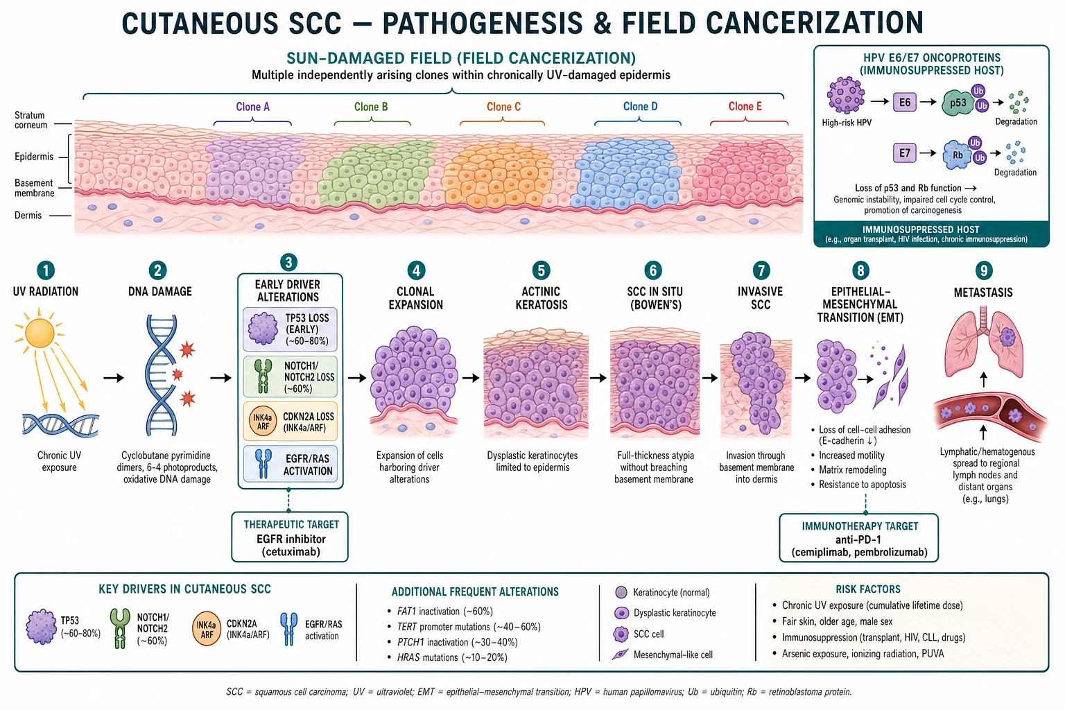 Diagram of UV-induced TP53, NOTCH1 and CDKN2A loss driving field cancerization and progression from actinic keratosis through SCC in situ to invasive SCC, with EGFR and anti-PD-1 therapeutic targets