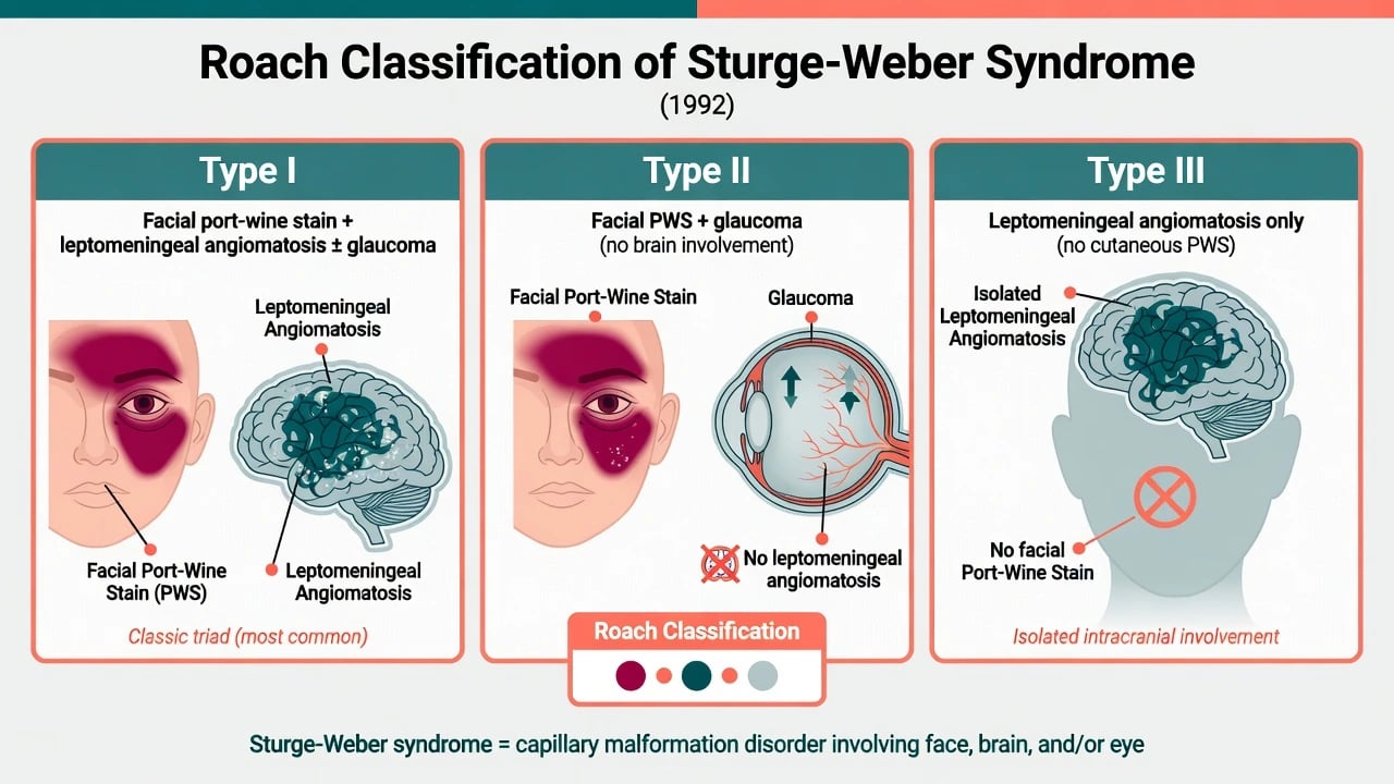 Roach classification Type I II III of Sturge-Weber syndrome