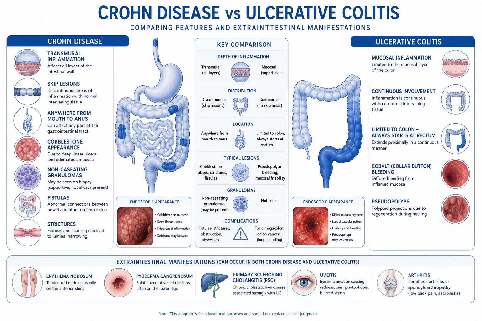 Pathophysiology of toxic megacolon: severe colitis, loss of motility, dilation, bacterial translocation and systemic toxicity