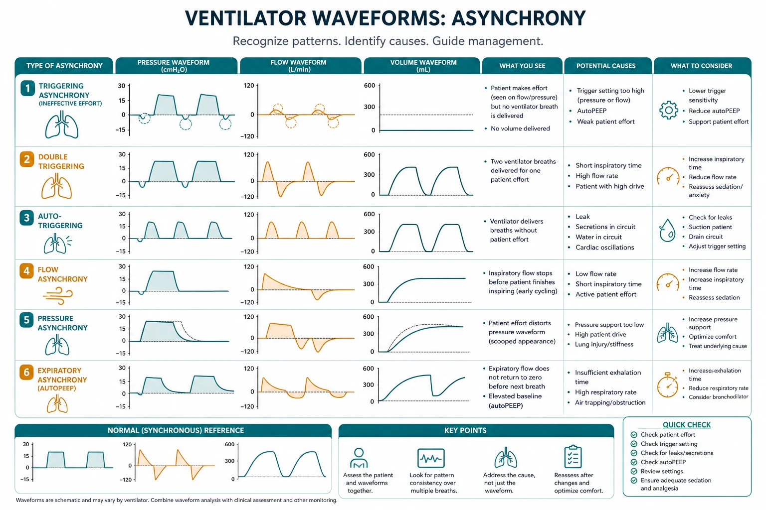 Four-panel educational diagram of patient-ventilator asynchrony types by respiratory cycle phase: ineffective trigger, auto-trigger, double trigger, delayed cycling