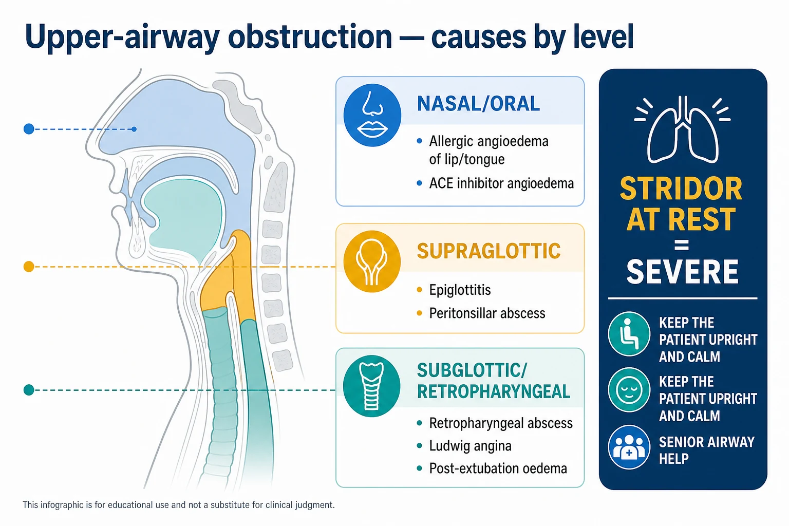 Vertical sagittal head-and-neck outline infographic on a white clinical-blue background with three highlighted zones: nasal/oral (allergic and ACE-inhibitor angioedema of lip/tongue), supraglottic (epiglottitis, peritonsillar abscess), and subglottic/retropharyngeal (retropharyngeal abscess, Ludwig angina, post-extubation oedema); banner 'Stridor at rest = severe; keep the patient upright and calm; senior airway help'. Flat vector illustration, crisp typography.