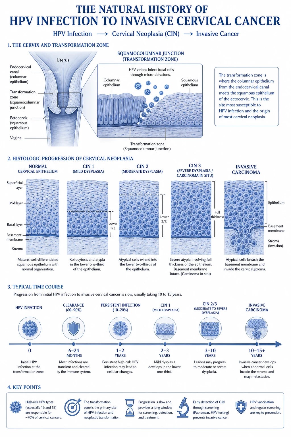 Cervical anatomy, HPV infection, and CIN progression to invasive cancer.