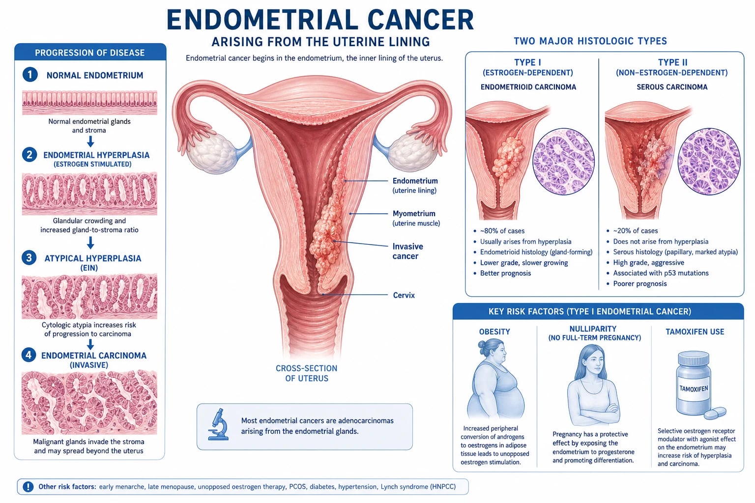 Uterine anatomy, the two pathogenetic types of endometrial cancer, and the hyperplasia to carcinoma sequence.