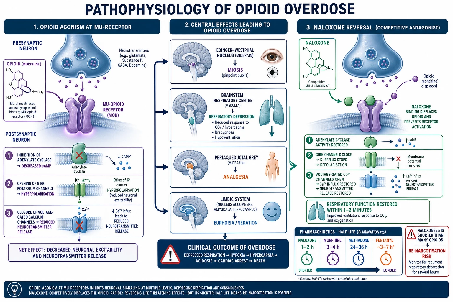 Clean modern medical diagram of opioid-overdose pathophysiology: neural synapse with mu-opioid receptor signalling and naloxone competitive antagonism, with arrows to the Edinger-Westphal nucleus, medullary respiratory centre, and a naloxone half-life vs opioid half-life inset