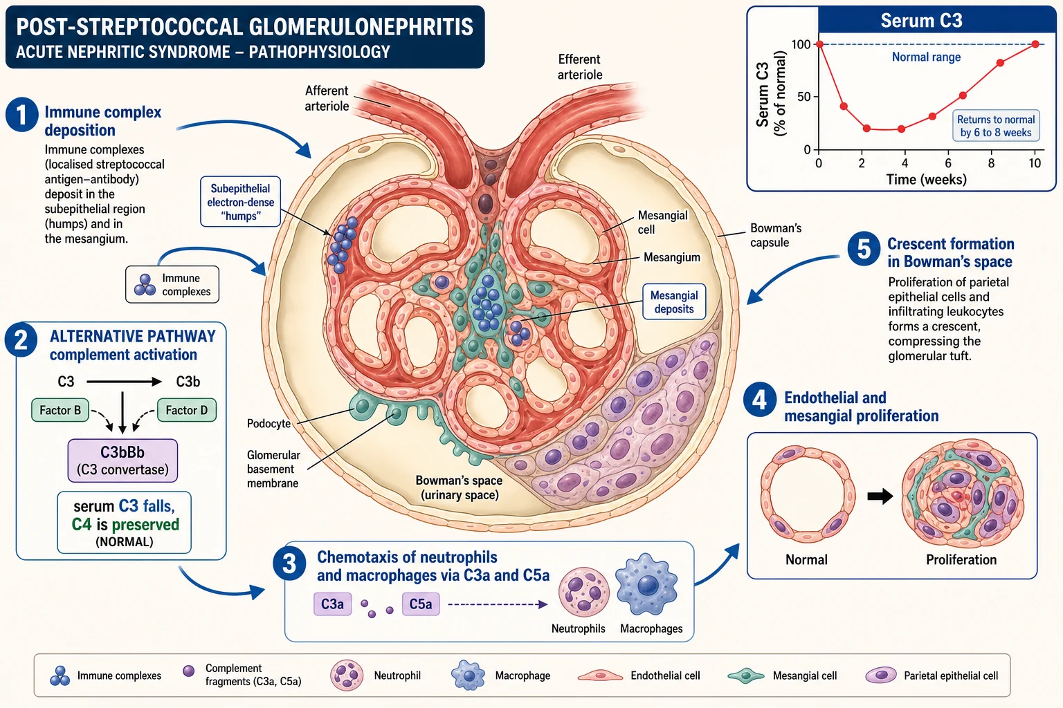 Mechanism of immune-complex glomerulonephritis showing antigen-antibody deposition, complement activation with falling C3, inflammatory infiltration, cellular proliferation and crescent formation