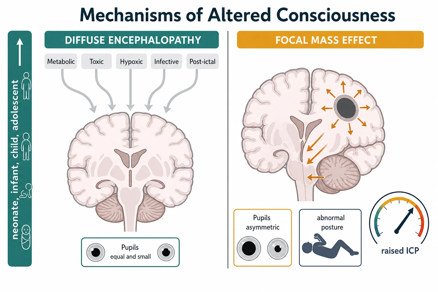 Reviewed educational schematic of the two mechanisms of altered consciousness: a diffuse encephalopathy cascade on the left (metabolic, toxic, hypoxic, infective and post-ictal factors lowering global hemisphere function) and a focal mass effect on the right (lesion, oedema and rising intracranial pressure compressing the brainstem with pupillary asymmetry and abnormal posture), with a vertical age band from neonate to adolescent