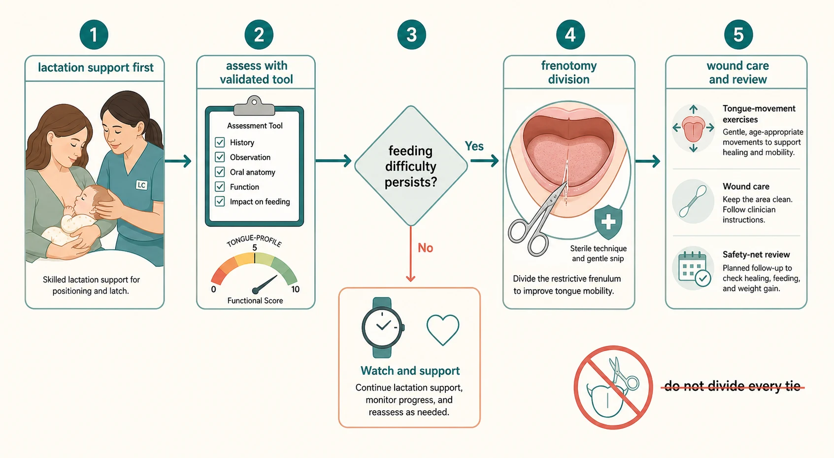Stepwise left-to-right management pathway: station one a lactation consultant helping a mother with positioning and latch labelled support first; station two a clipboard with a checklist and tongue-profile gauge labelled assess with a validated tool; station three a decision diamond labelled feeding difficulty persists with a yes arrow continuing and a no arrow to a reassuring watch-and-support icon; station four a frenotomy station showing a small stylised snip of the frenulum by sterile scissors with a swab and shield labelled frenotomy division; station five a post-procedure wound-care icon with gentle tongue-movement exercises and a safety-net review; bottom right a crossed-out circle over scissors applied to every tongue with a struck-through label do not divide every tie.