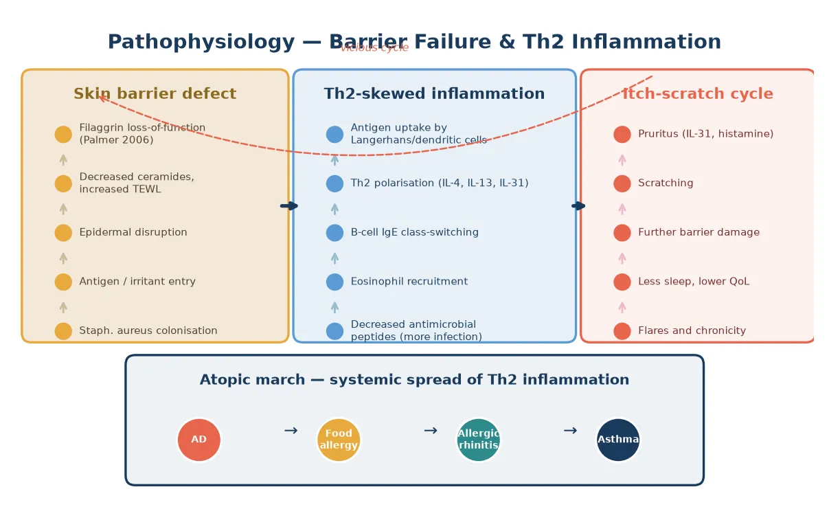 Pathophysiology cascade from filaggrin barrier defect through Th2-skewed inflammation to the itch-scratch cycle and downstream atopic march to food allergy, rhinitis and asthma