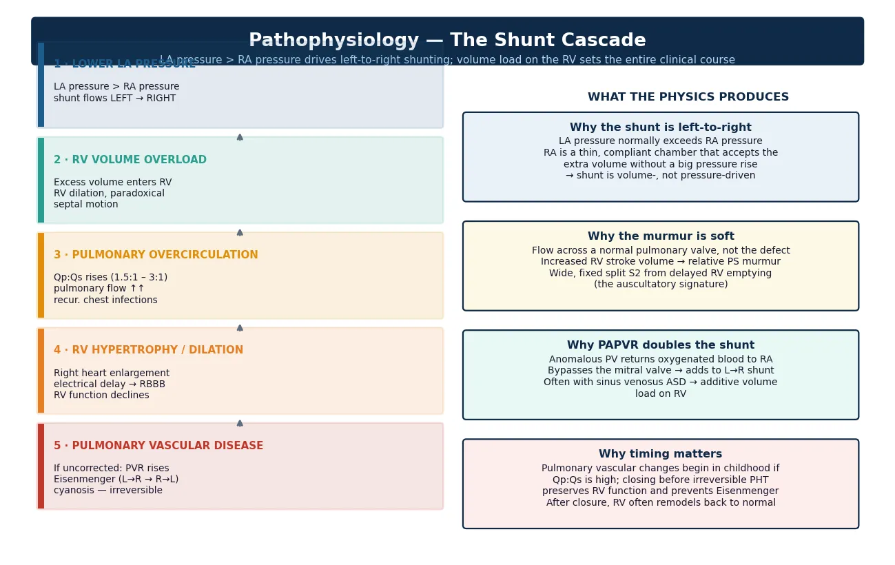 Vertical cascade of five steps from the left-to-right shunt through right ventricular volume overload, pulmonary over-circulation, right ventricular hypertrophy with right bundle branch block, to irreversible pulmonary vascular disease with Eisenmenger physiology, beside four explanatory cards on why the shunt is left-to-right, why the murmur is soft, why partial anomalous venous return doubles the shunt, and why timing of closure matters