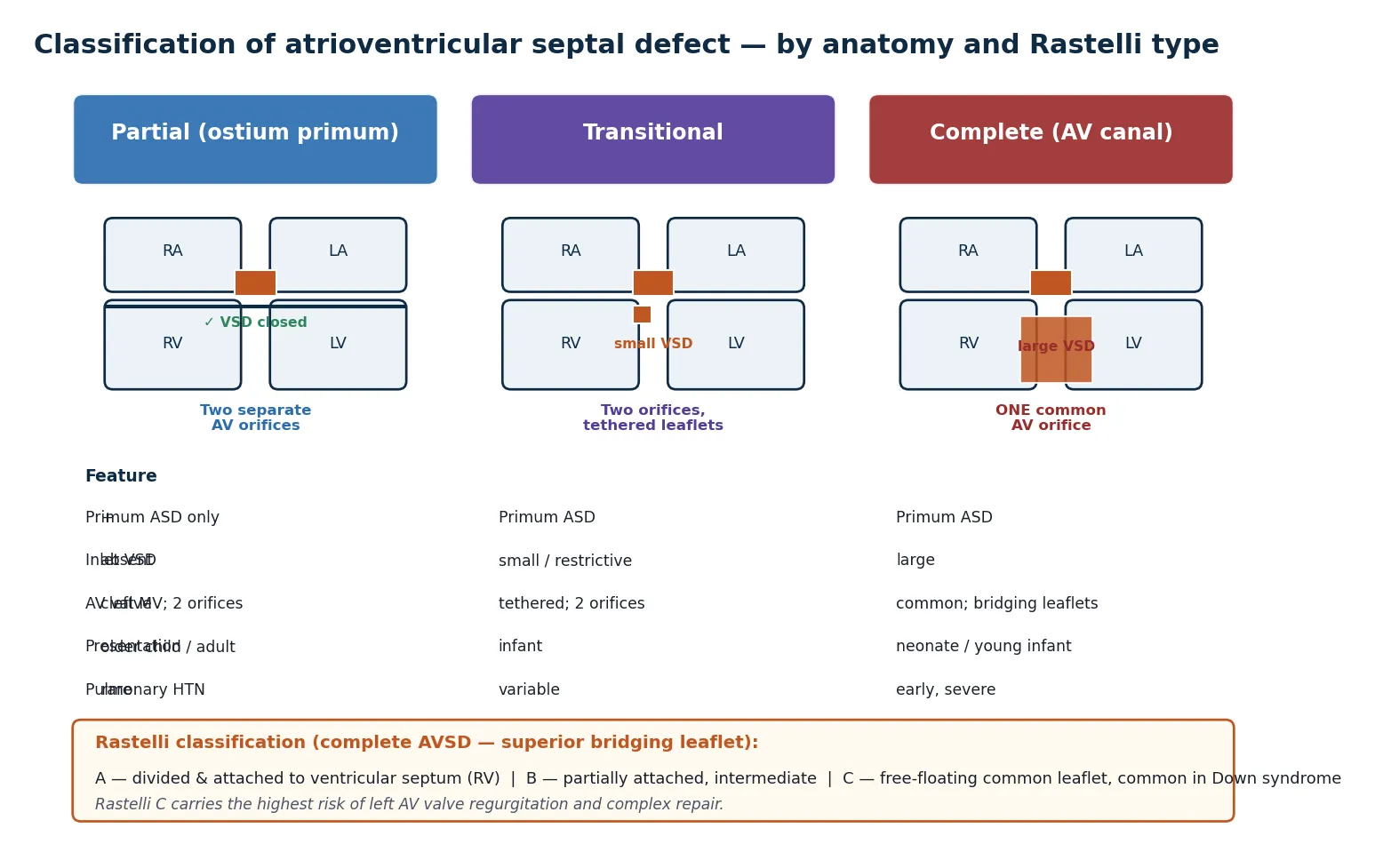 Three columns comparing partial, transitional and complete AVSD anatomy with primum ASD and inlet VSD depictions and the Rastelli subtypes