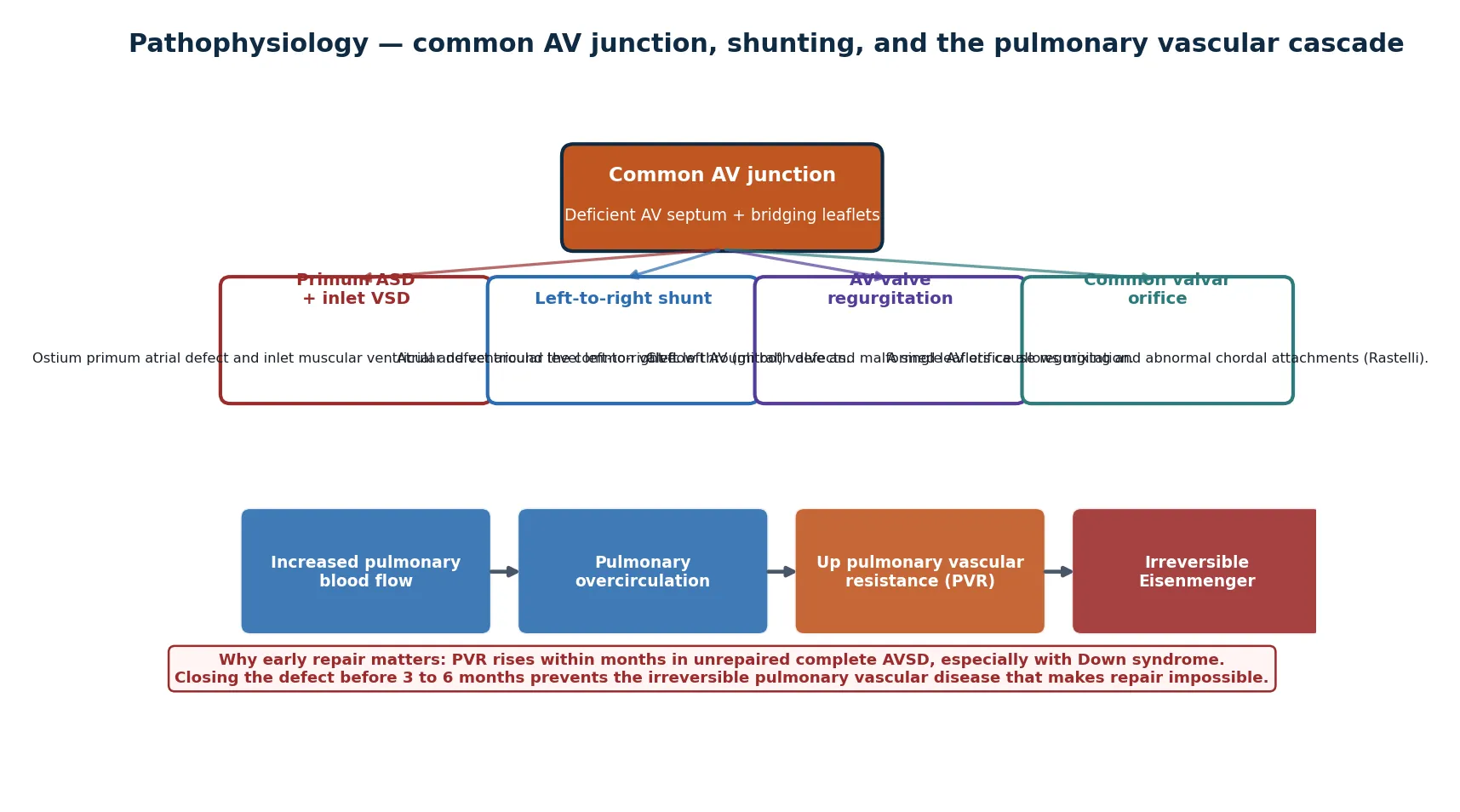 Flow diagram from the common AV junction through primum ASD, inlet VSD, AV valve regurgitation and common orifice to the pulmonary vascular cascade ending in Eisenmenger