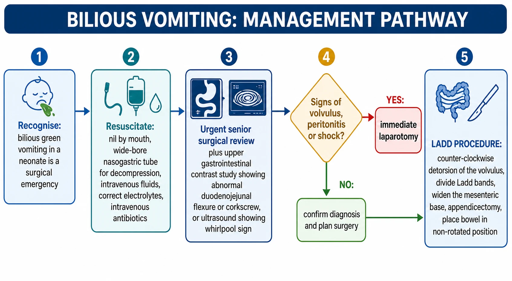 Management pathway flowchart for bilious vomiting. Step one recognise bilious green vomiting in a neonate as a surgical emergency. Step two resuscitate with nil by mouth, wide-bore nasogastric tube decompression, intravenous fluids, electrolyte correction and antibiotics. Step three urgent senior surgical review plus upper gastrointestinal contrast study or ultrasound. Step four a decision point on signs of volvulus, peritonitis or shock, with an immediate laparotomy branch if yes and confirm and plan if no. Step five the Ladd procedure of detorsion, division of Ladd bands, widening the mesenteric base, appendicectomy and non-rotated bowel placement.