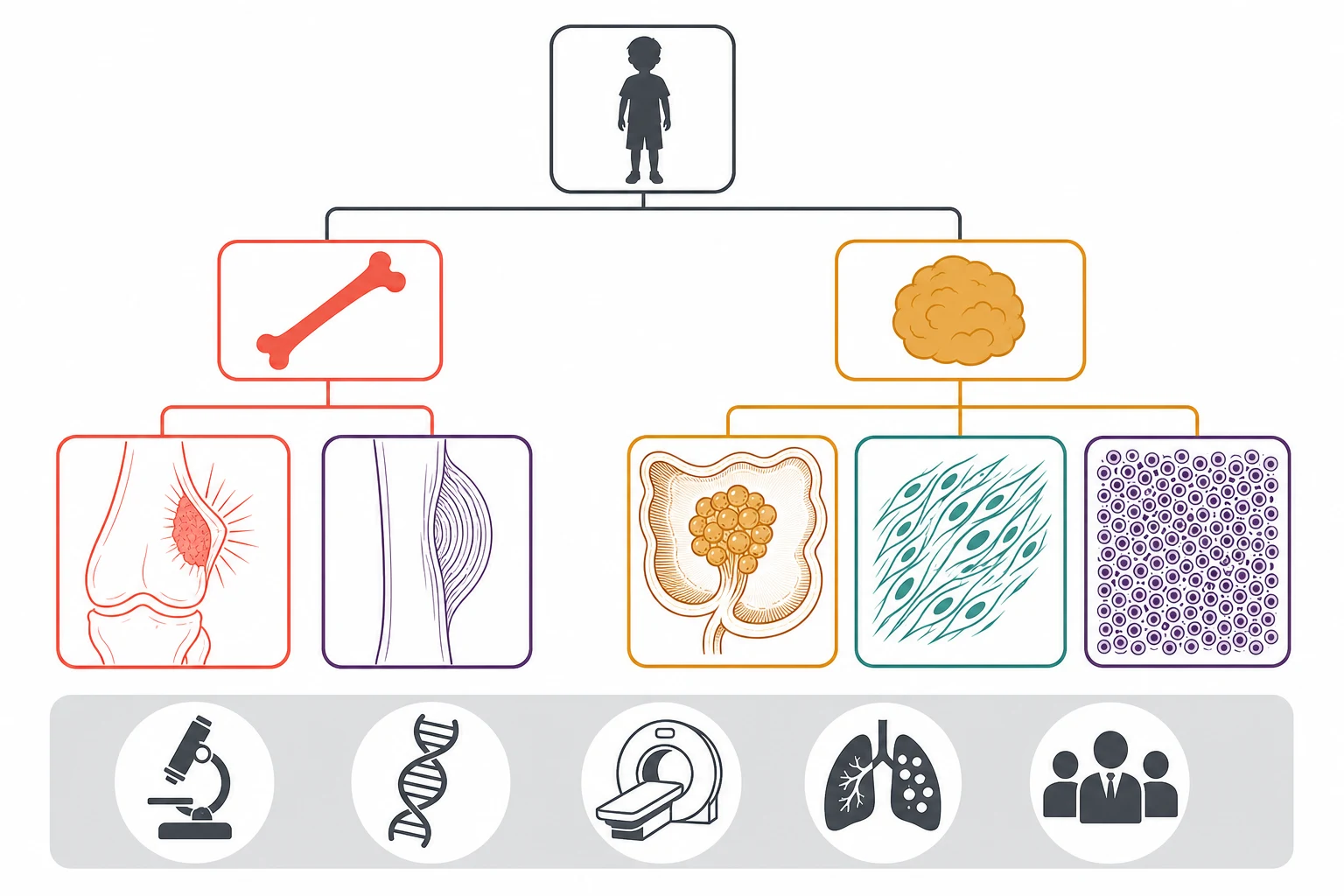 A clean medical-education schematic on a white background showing a two-tier tree. A child silhouette node at the top splits into a coral bone-sarcoma branch holding an osteoid-producing distal-femur mass with a sunburst and a deep-purple round-cell diaphyseal mass with onion-skin layers, and an amber soft-tissue-sarcoma branch holding a grape-like botryoid cluster, a spindle-cell bundle and a round-cell sheet. A grey footer ribbon holds five monochrome chips for histology, fusion, imaging, metastasis and the multidisciplinary team. No text appears in the figure.