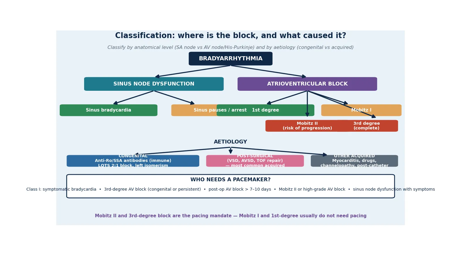 Educational schematic classifying paediatric bradyarrhythmia into sinus node dysfunction and atrioventricular block, with AV block subdivided into first-degree, Mobitz I Wenckebach, Mobitz II and third-degree complete heart block, plus an aetiology band of congenital anti-Ro immune, post-surgical, and other acquired causes, and a pacing-indication summary