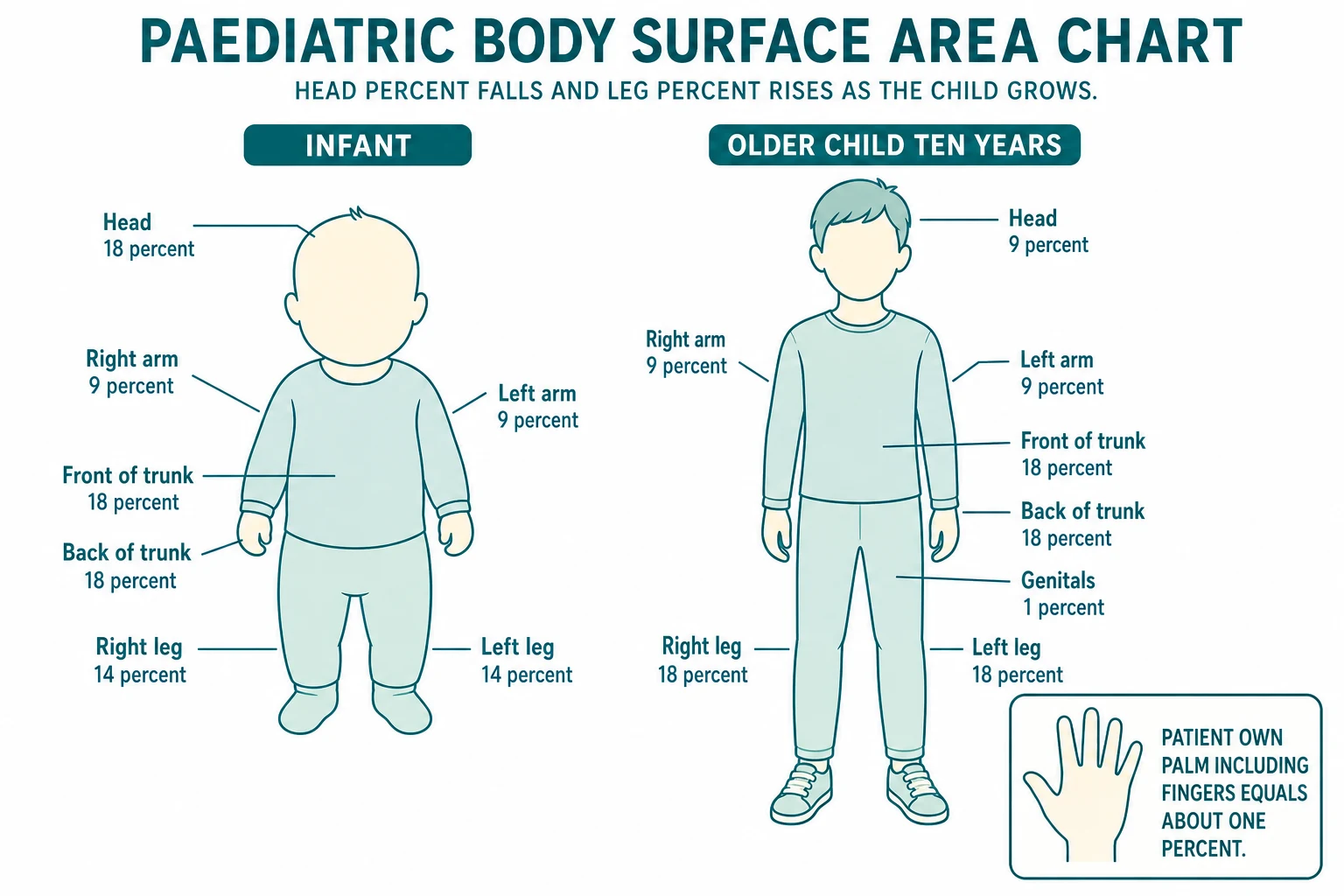 Reviewed educational schematic of an age-adjusted paediatric body surface area chart in the style of Lund and Browder, showing two body outlines side by side labelled Infant and Older Child Ten Years, with region percentages that each sum to 100, and an inset showing the patient own palm including fingers equal to about one percent of body surface area