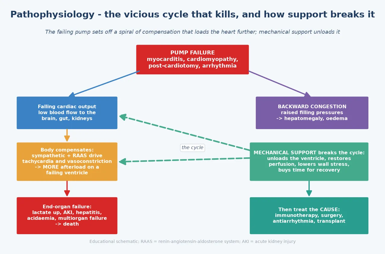Pathophysiology of cardiogenic shock as a vicious cycle. A pump-failure trigger (myocarditis, cardiomyopathy, post-cardiotomy, arrhythmia) lowers cardiac output. Forward failure sends low blood flow to the brain, gut and kidneys. The body compensates with sympathetic and renin-angiotensin-aldosterone activation, driving tachycardia and vasoconstriction, which raises the afterload on the failing ventricle. Backward failure raises filling pressures and produces congestion (hepatomegaly, oedema). The cycle drives end-organ failure (rising lactate, acute kidney injury, hepatitis, acidaemia, death) unless mechanical support breaks it: the device unloads the ventricle, restores perfusion, lowers wall stress, and buys time for recovery; then the cause is treated.